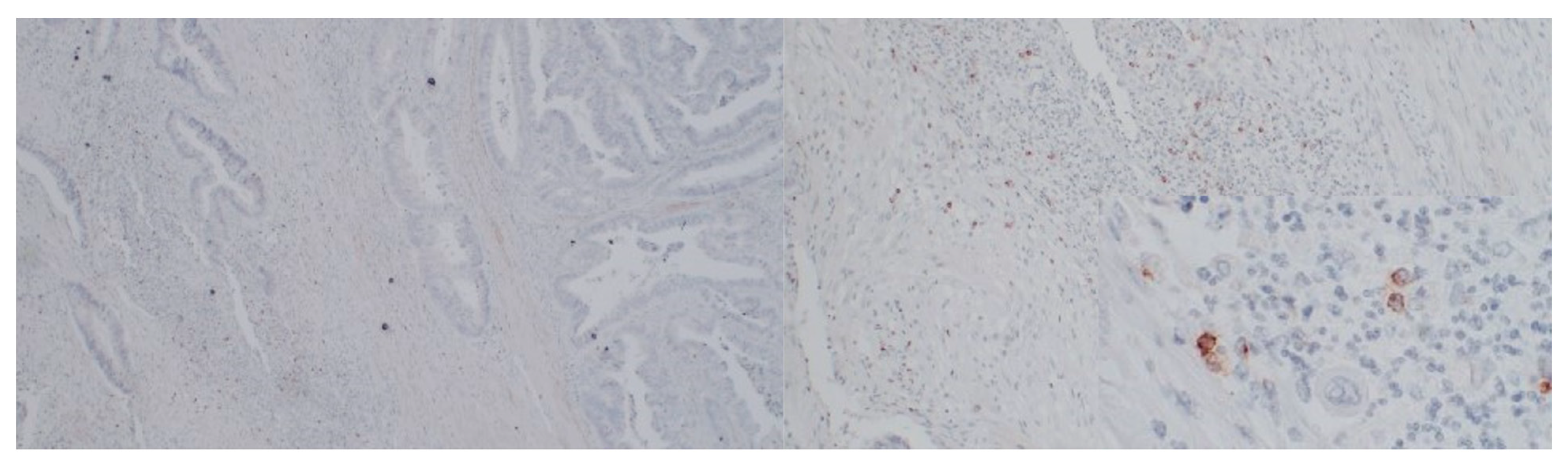 Medicina 58 00203 g004