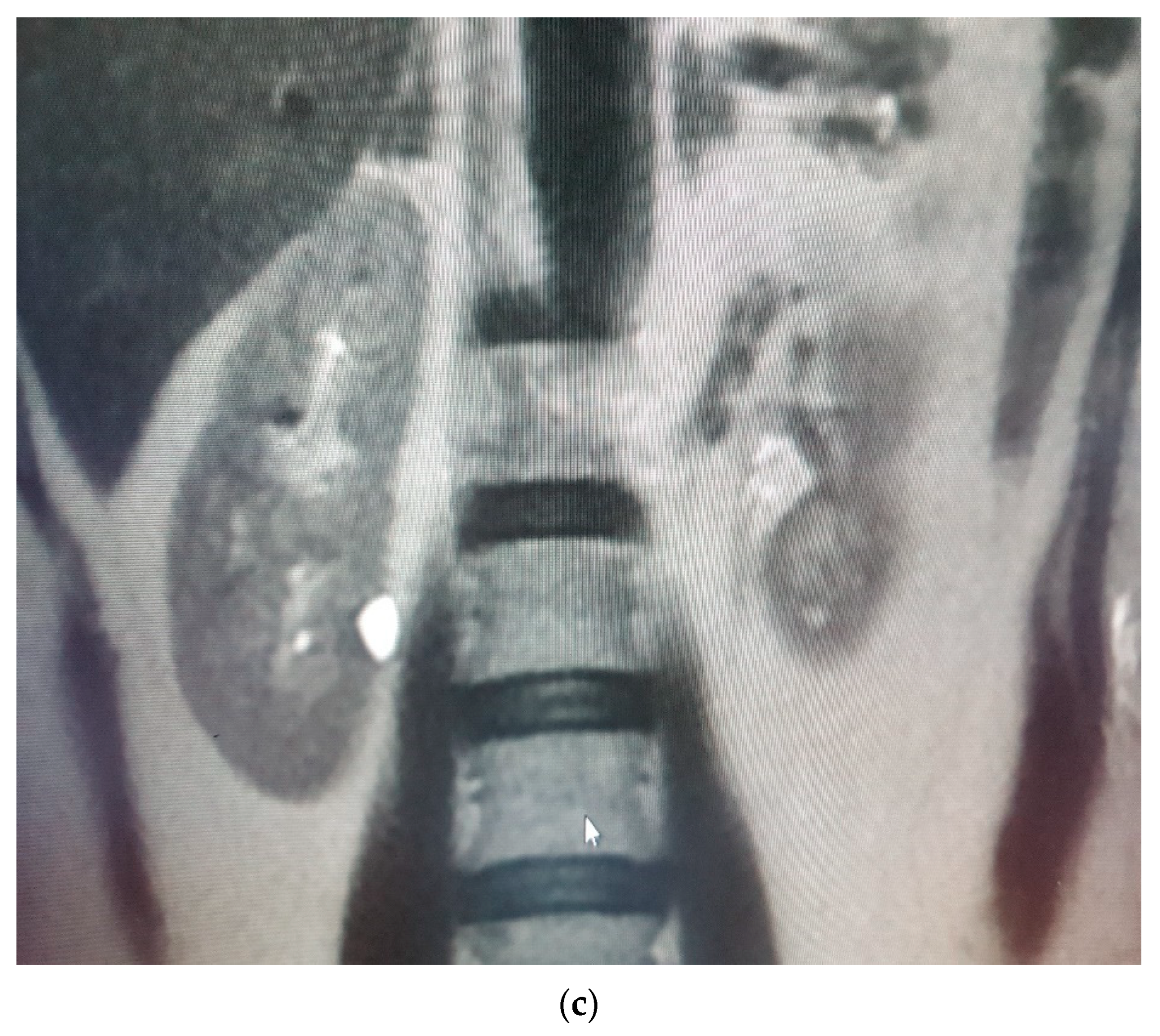 Medicina 58 00221 g004b