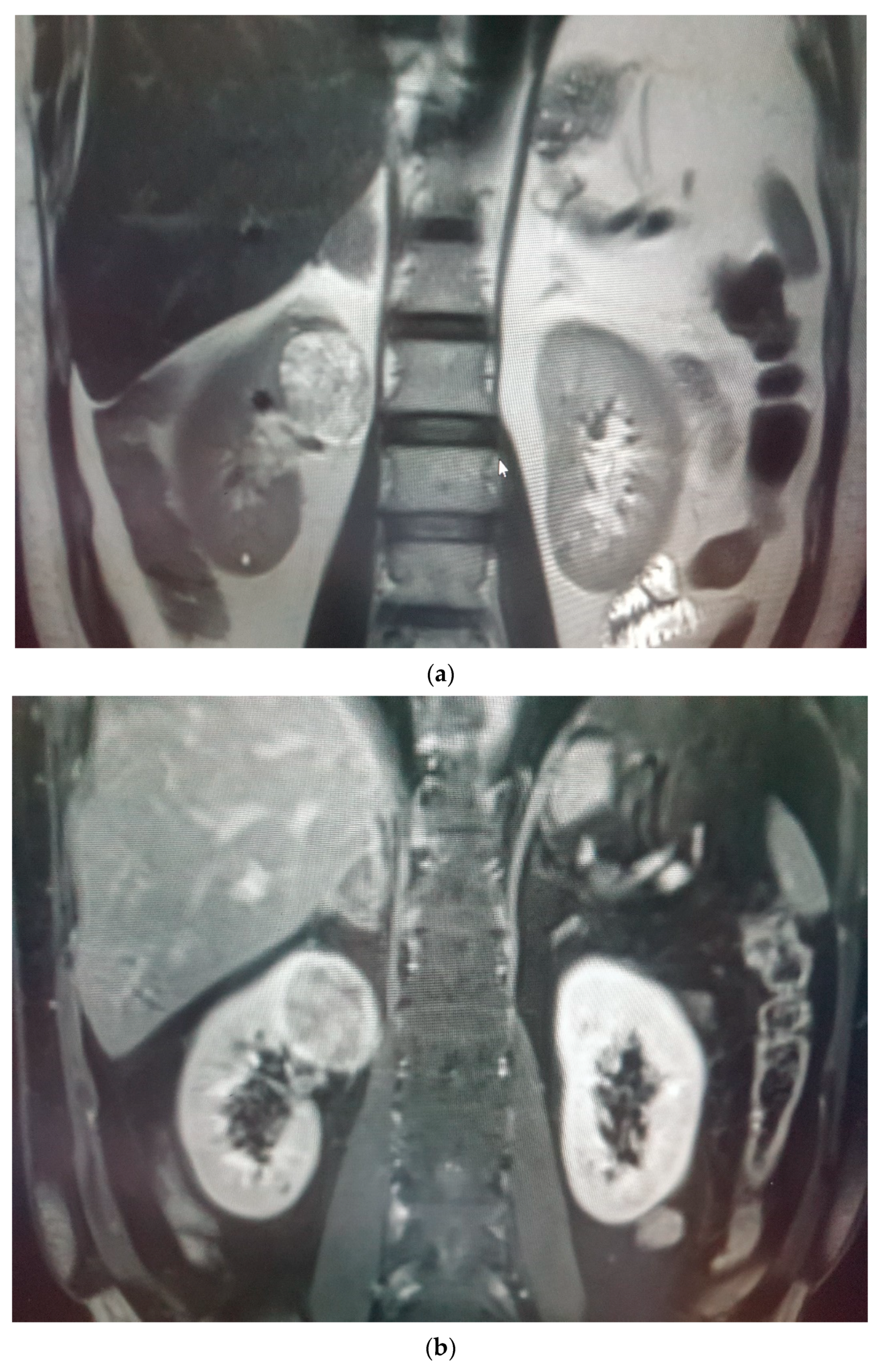 Medicina 58 00221 g005