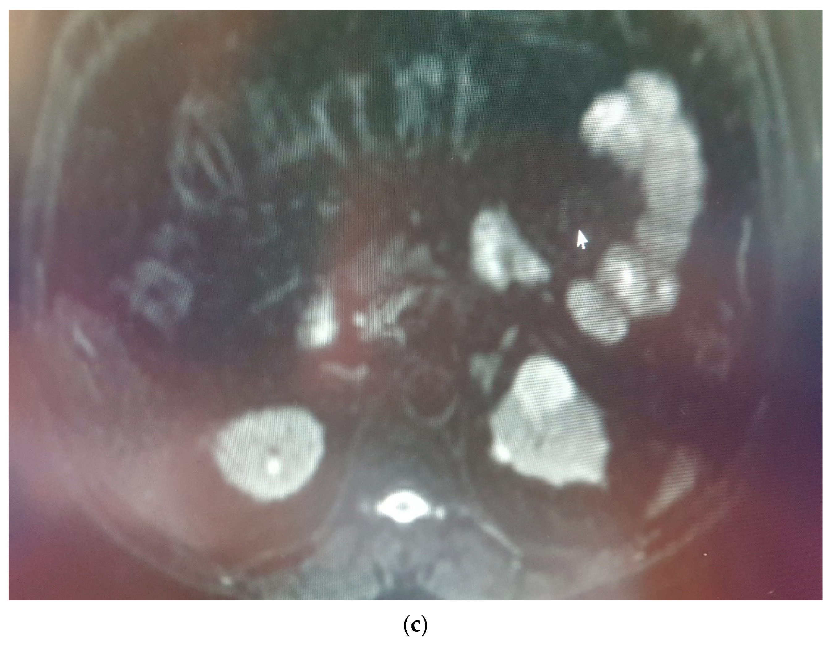 Medicina 58 00221 g006b