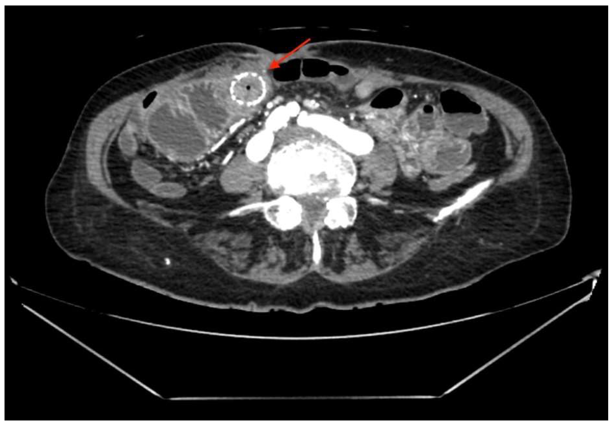 Medicina 58 00223 g001 550