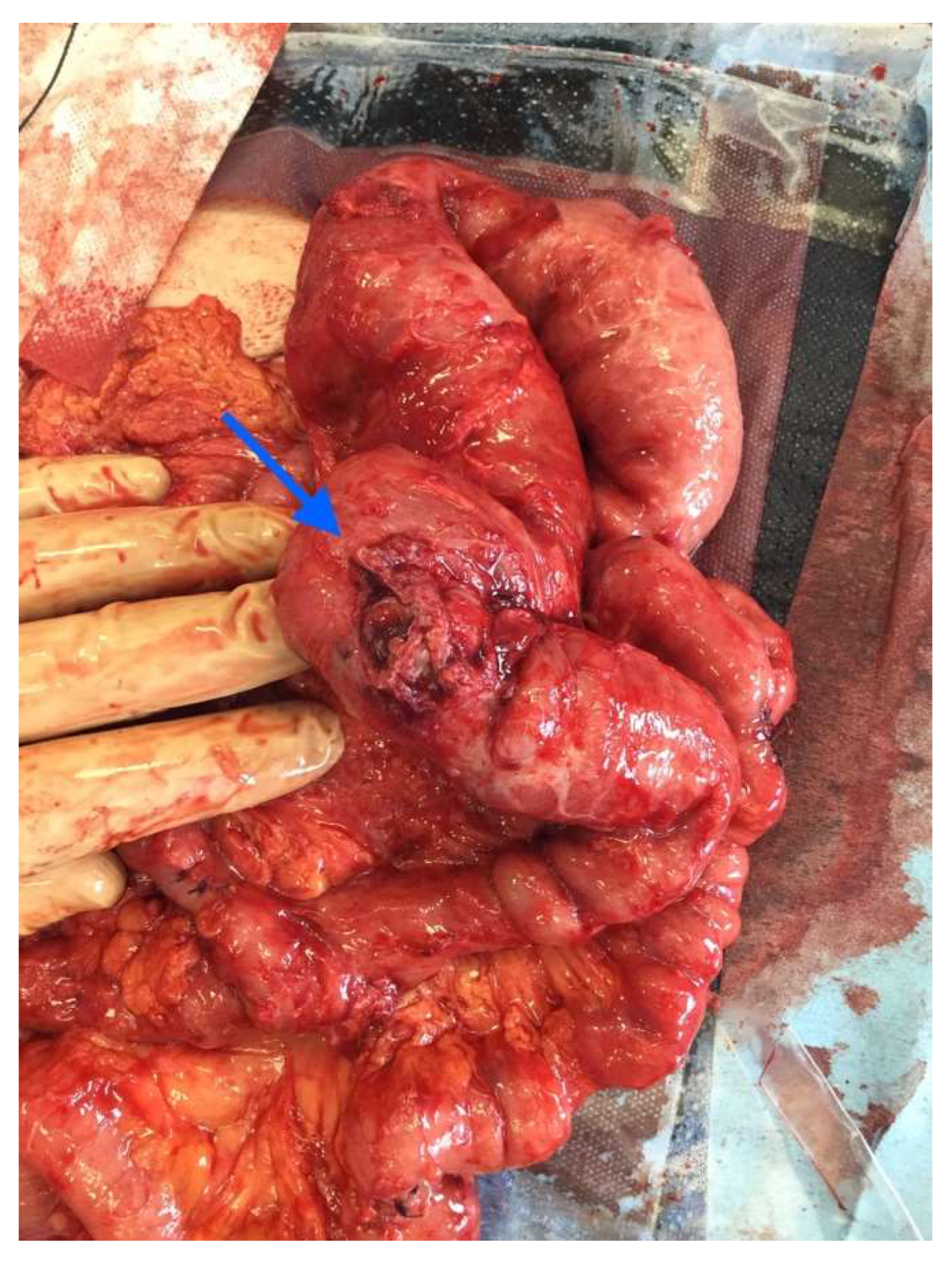 Medicina 58 00223 g003 550