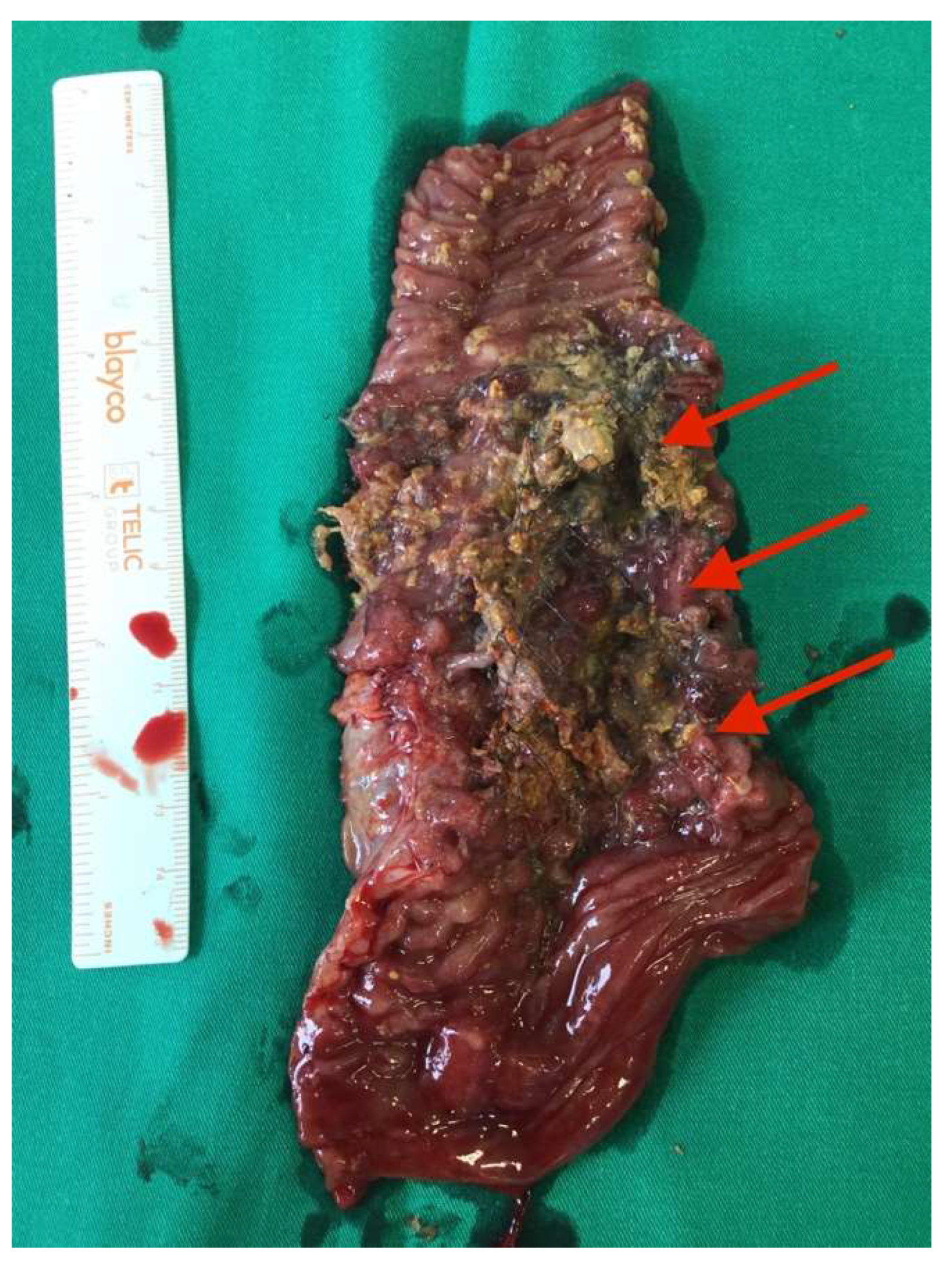 Medicina 58 00223 g004 550