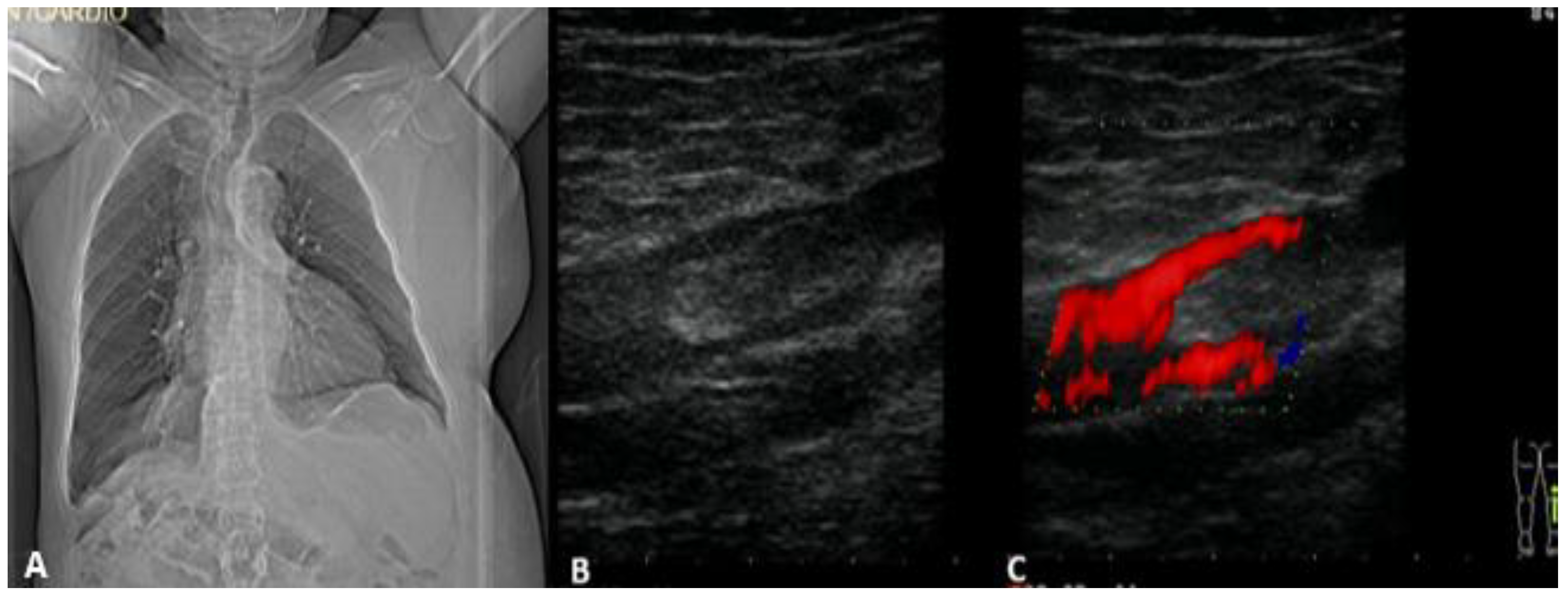 Medicina 58 00230 g001 550
