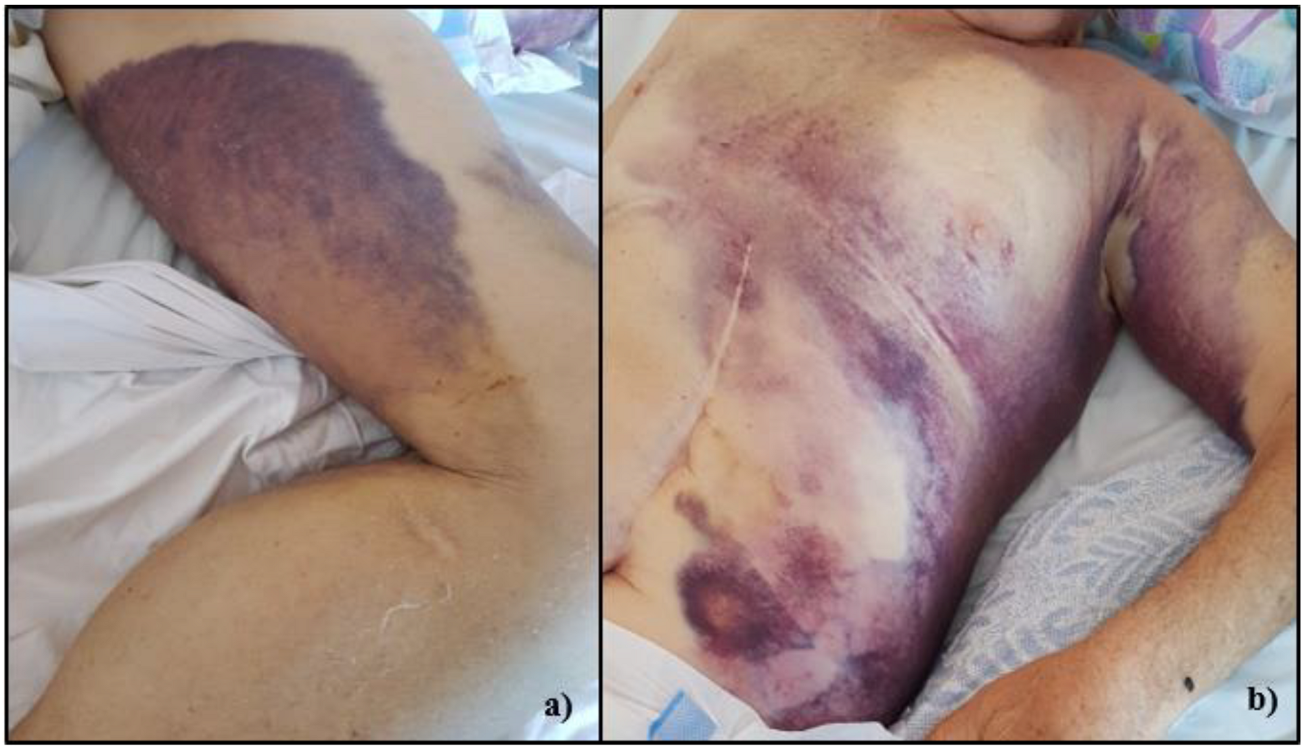 Medicina 58 00230 g002 550