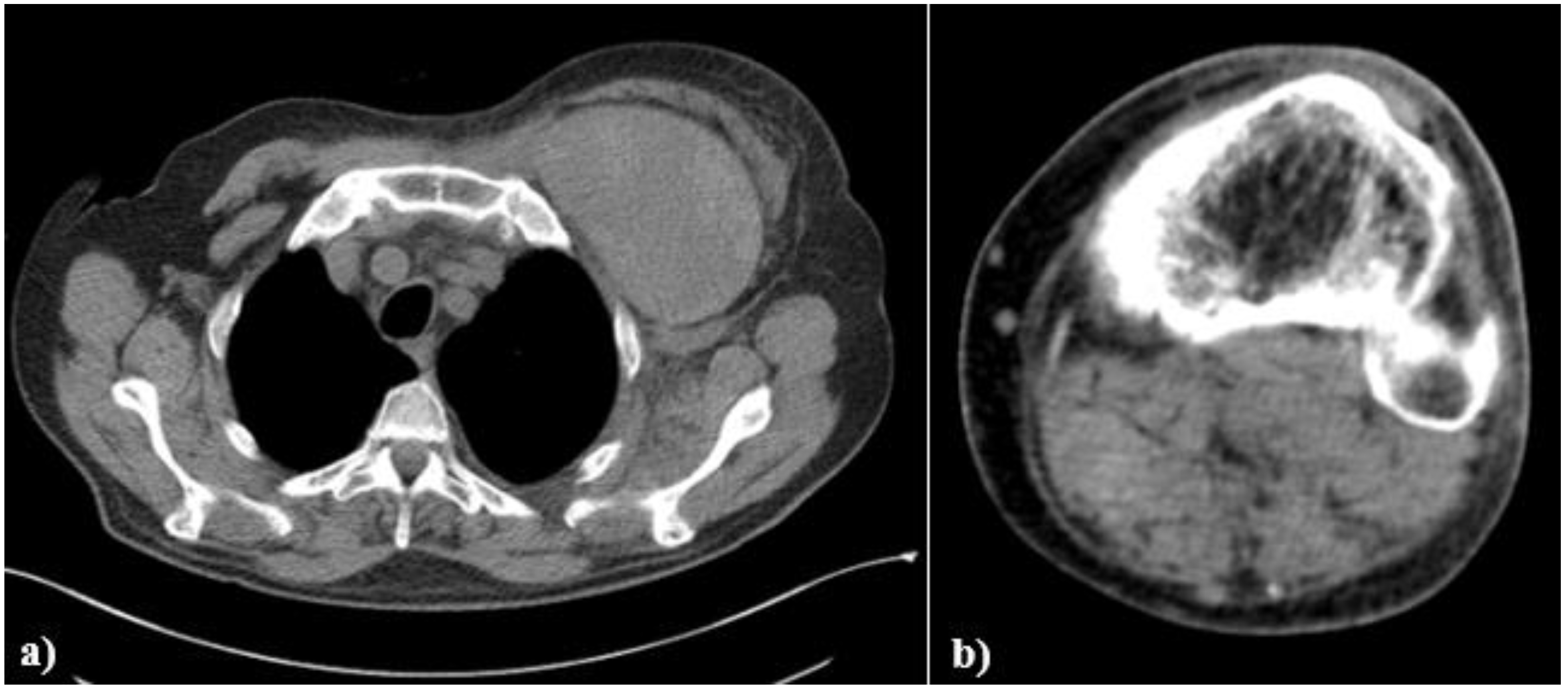 Medicina 58 00230 g003 550