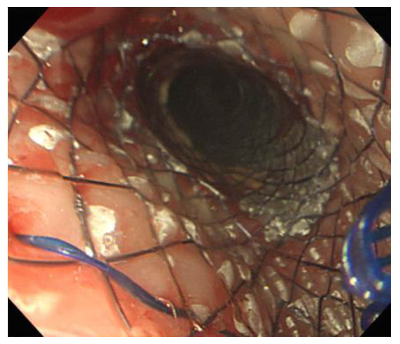 Medicina 58 00231 g001 550