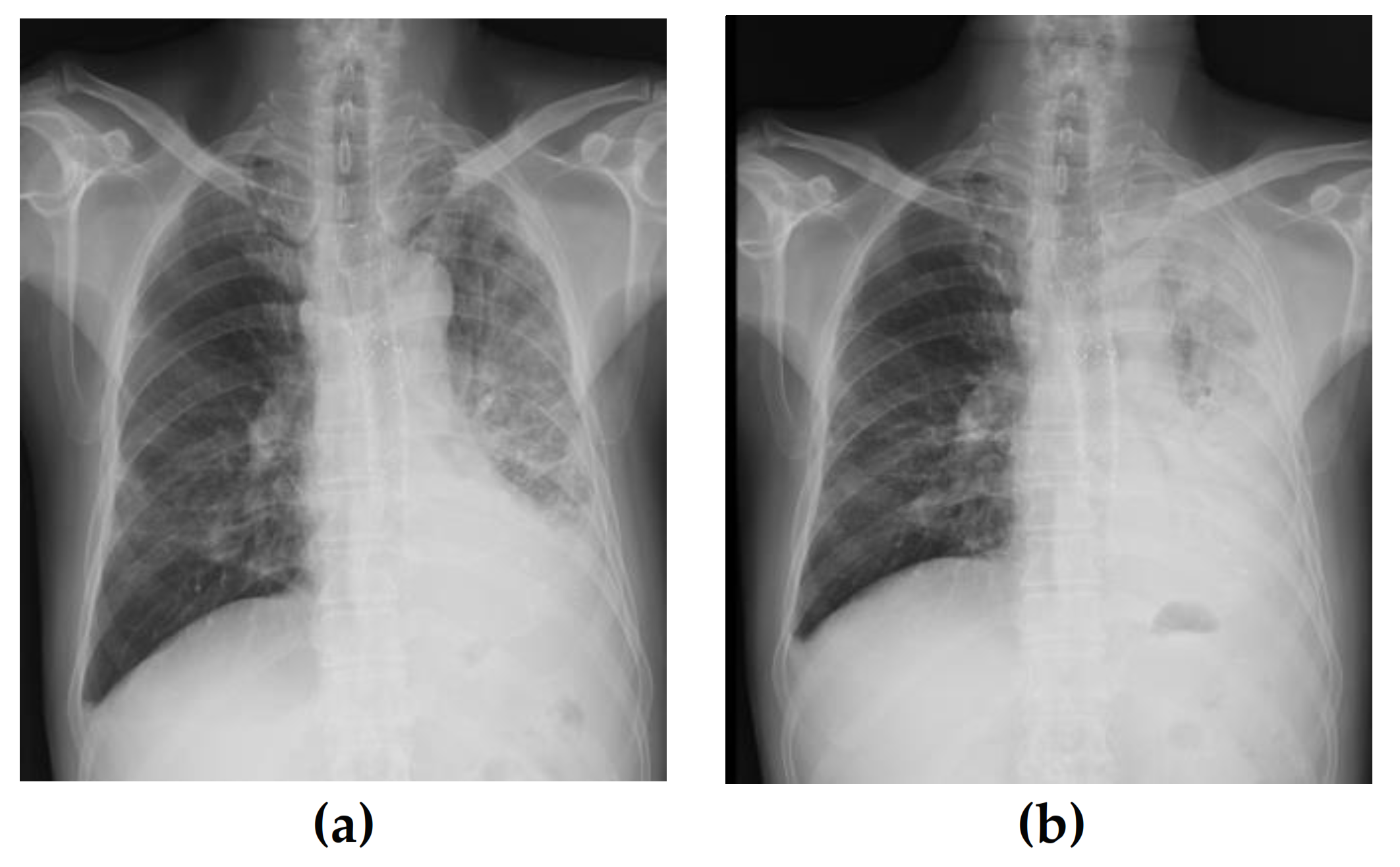 Medicina 58 00231 g002 550