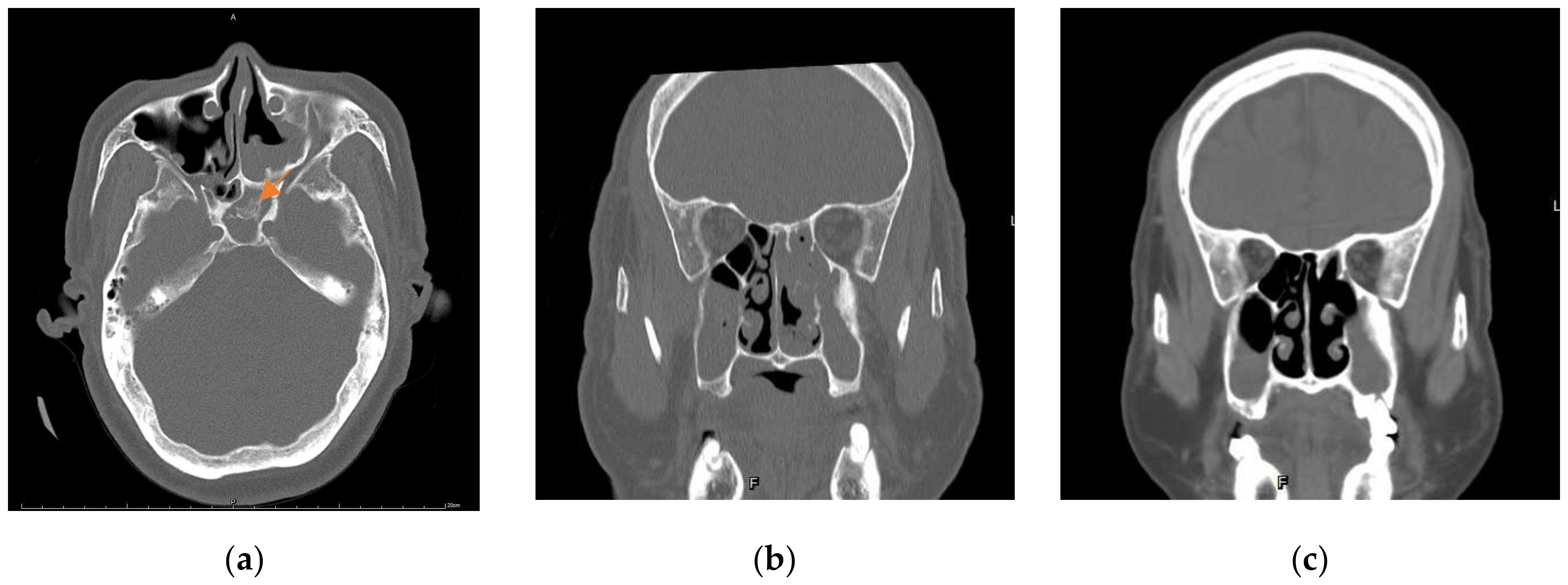 Medicina 58 00236 g001 550