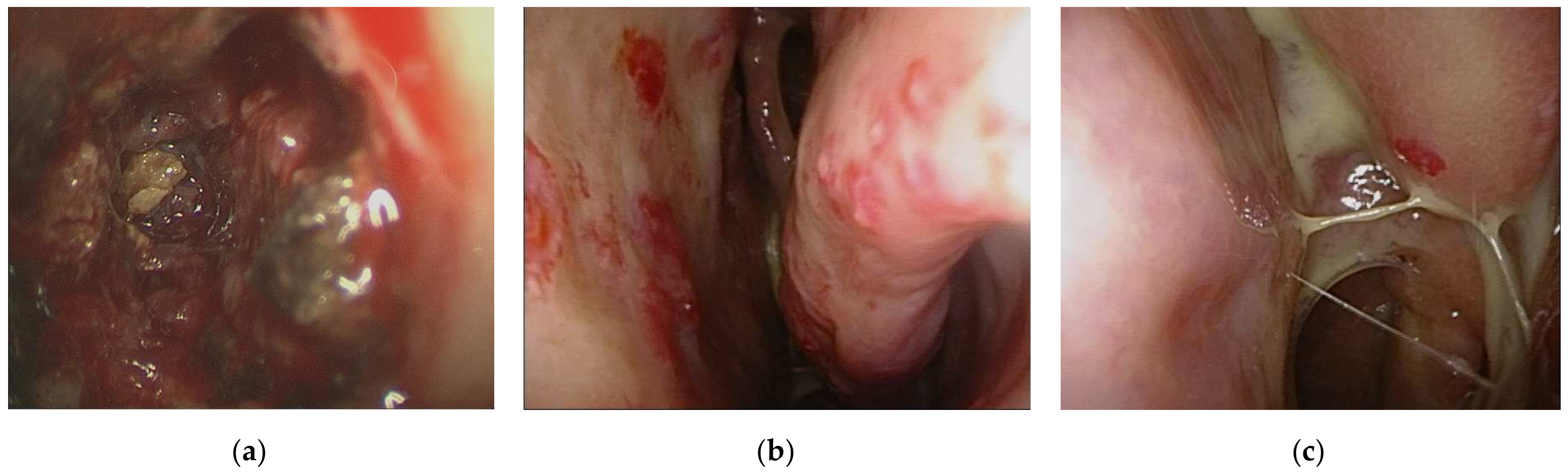 Medicina 58 00236 g002 550
