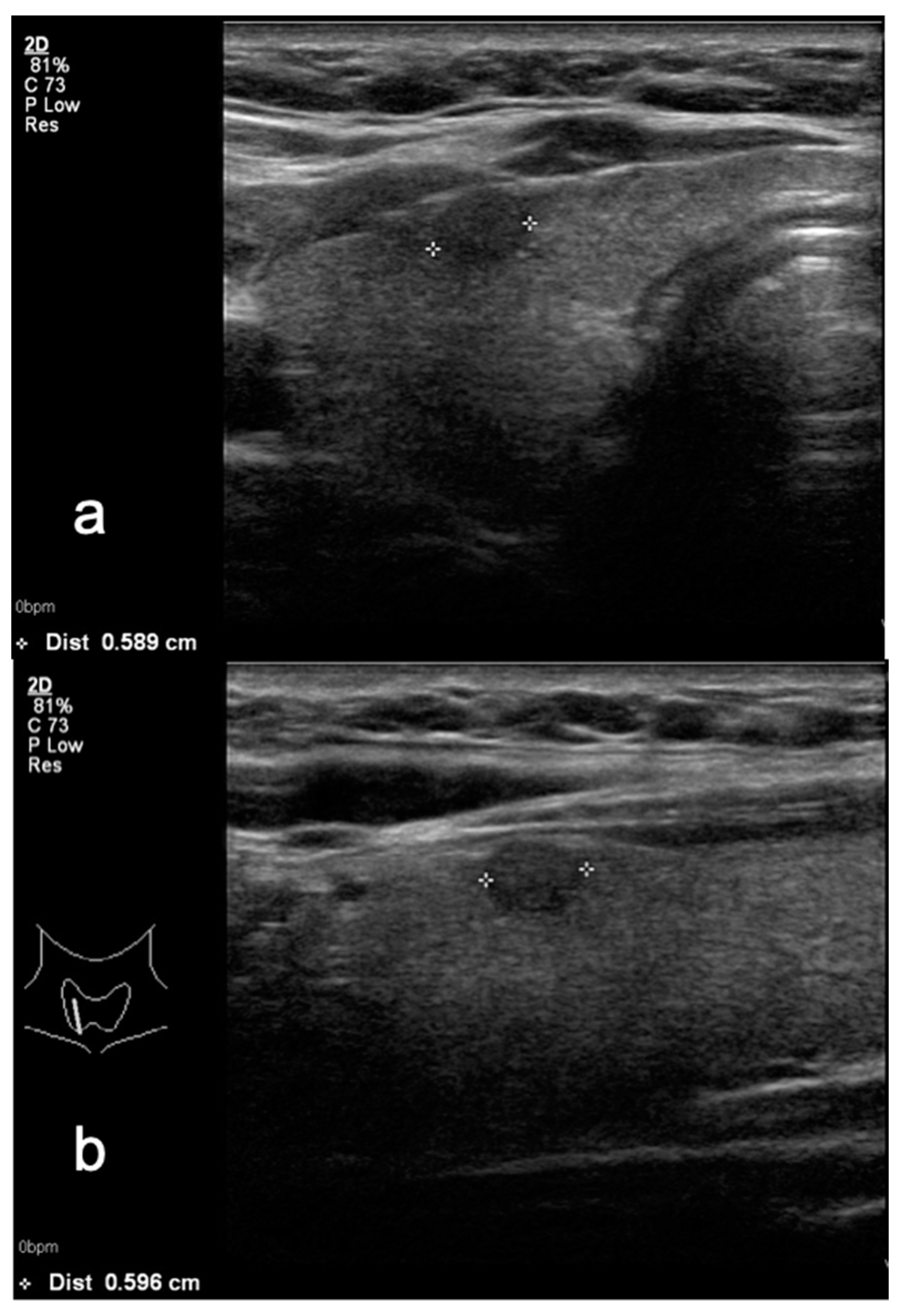 Medicina 58 00257 g003 550
