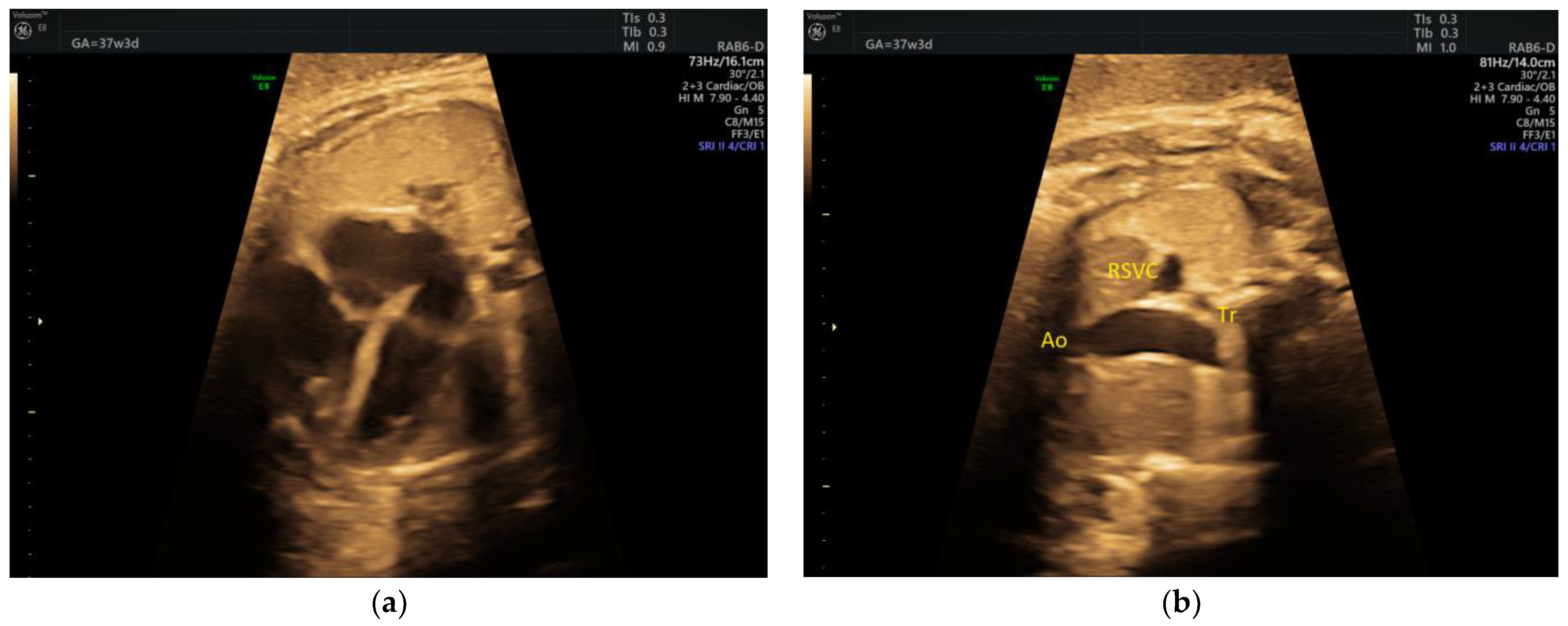 Medicina 58 00262 g001 550