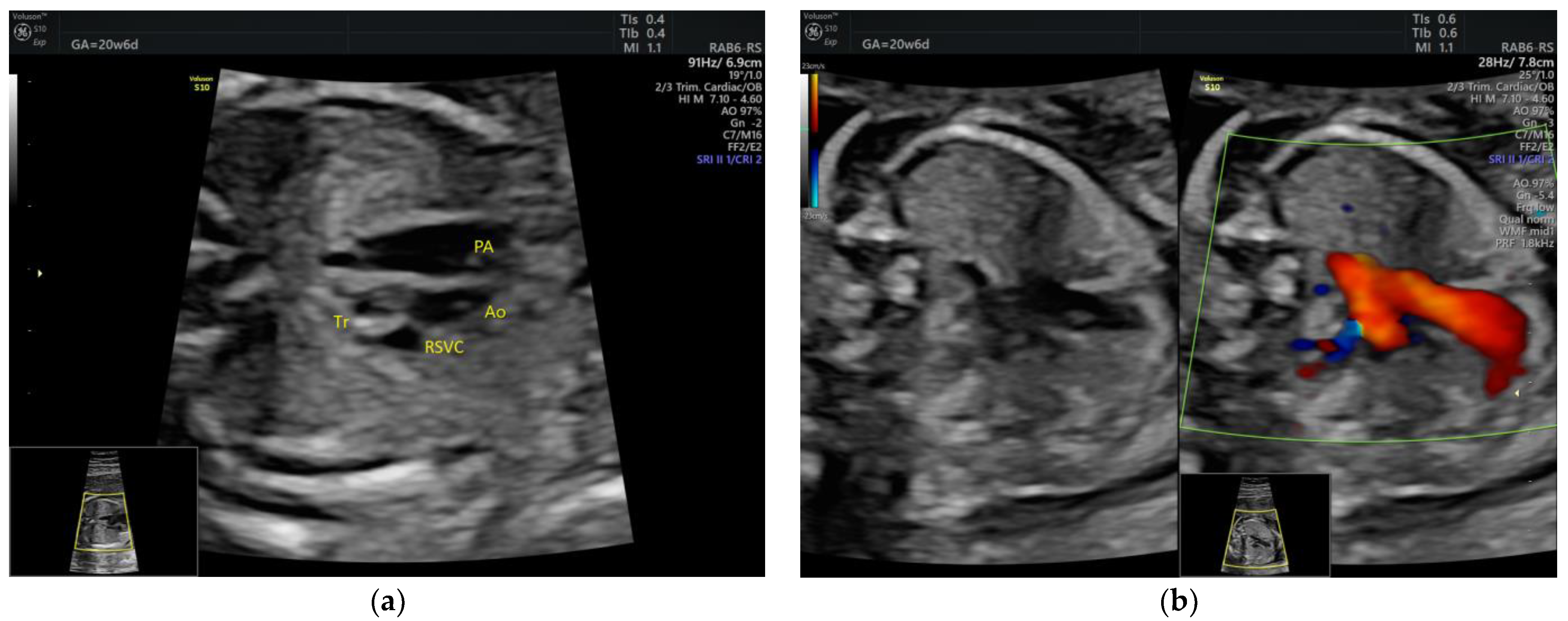 Medicina 58 00262 g004 550