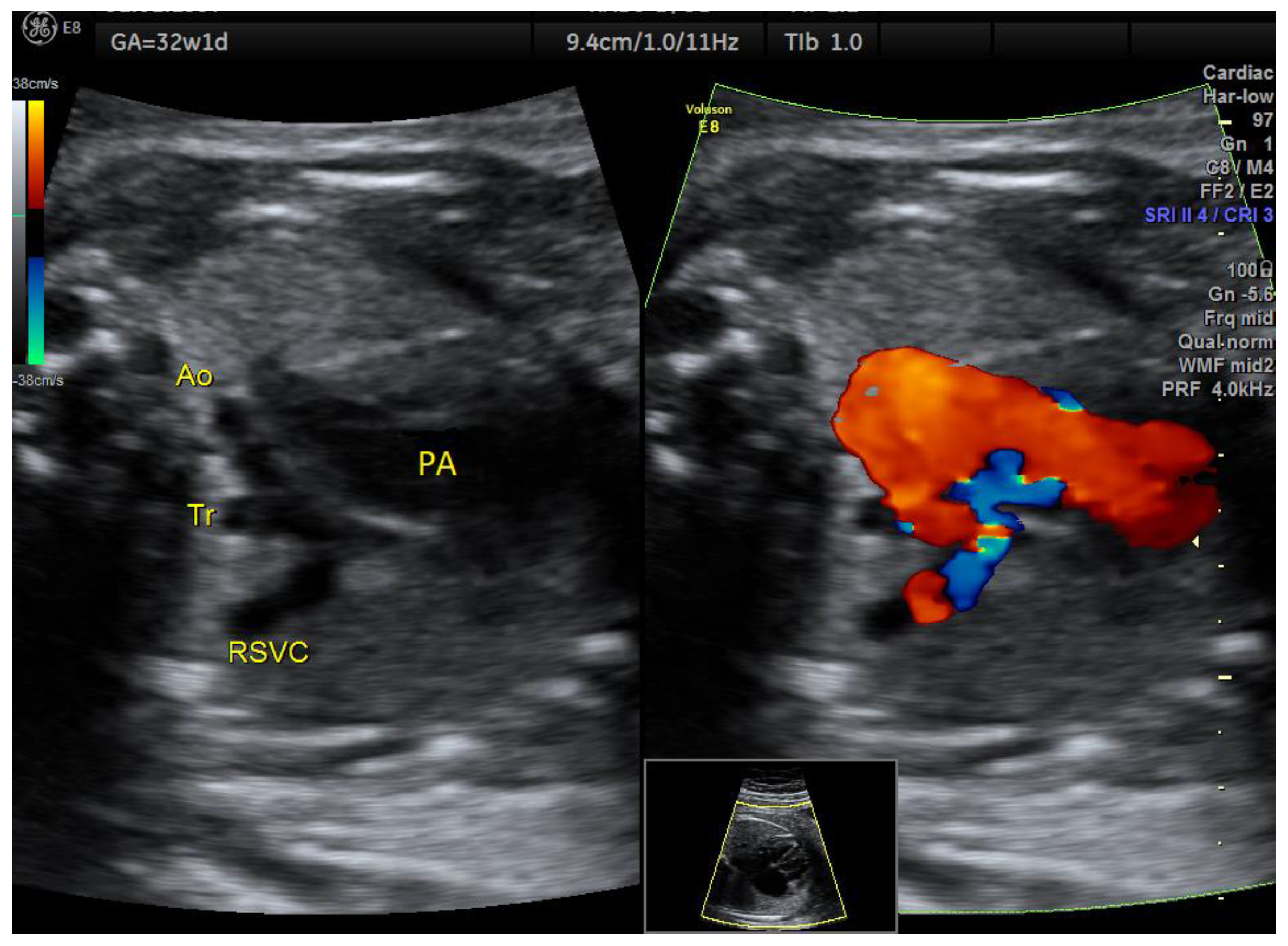 Medicina 58 00262 g005 550