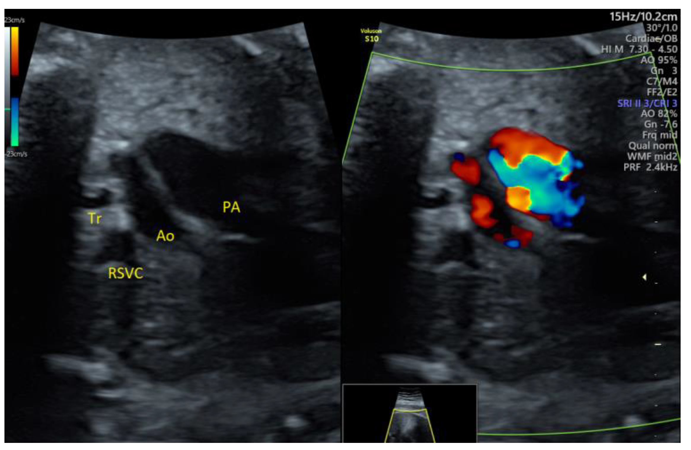 Medicina 58 00262 g007 550