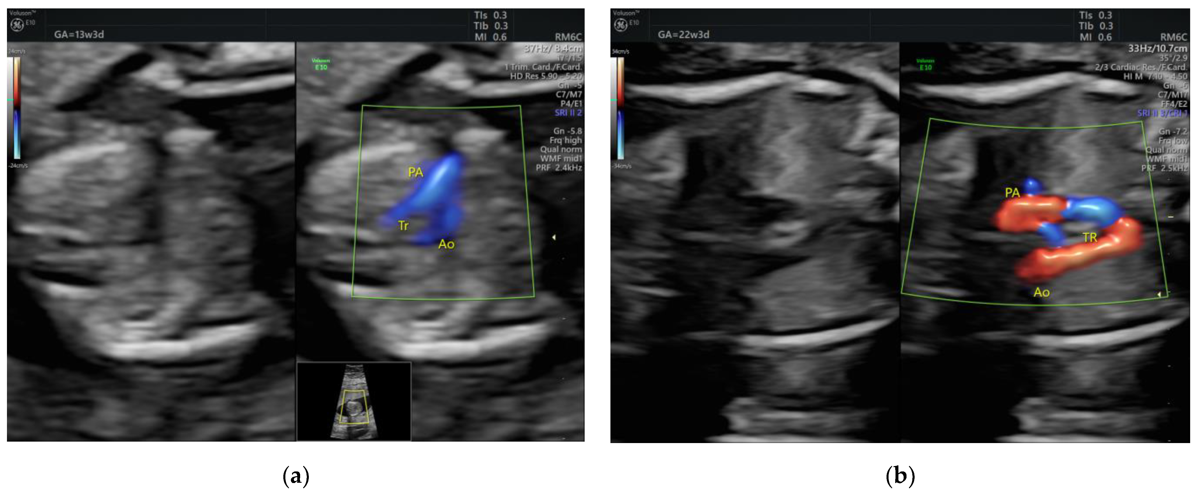 Medicina 58 00262 g009 550