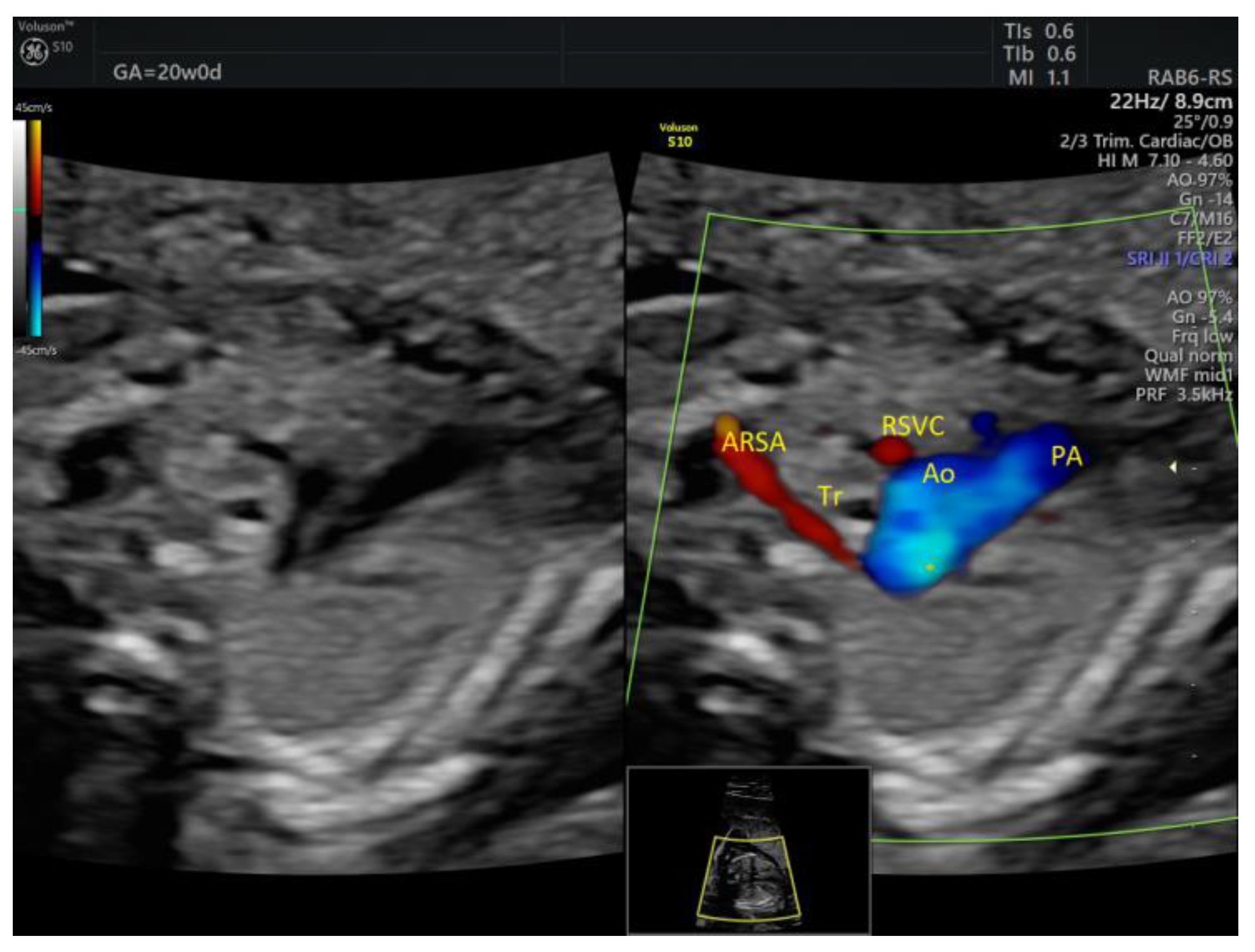 Medicina 58 00262 g010 550