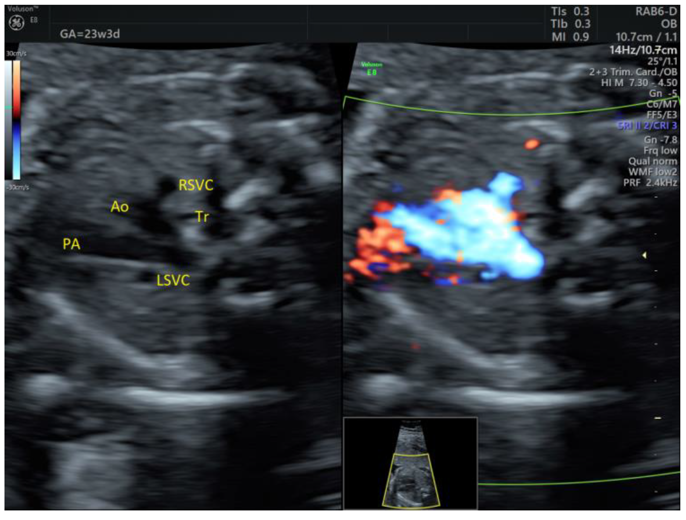 Medicina 58 00262 g011 550
