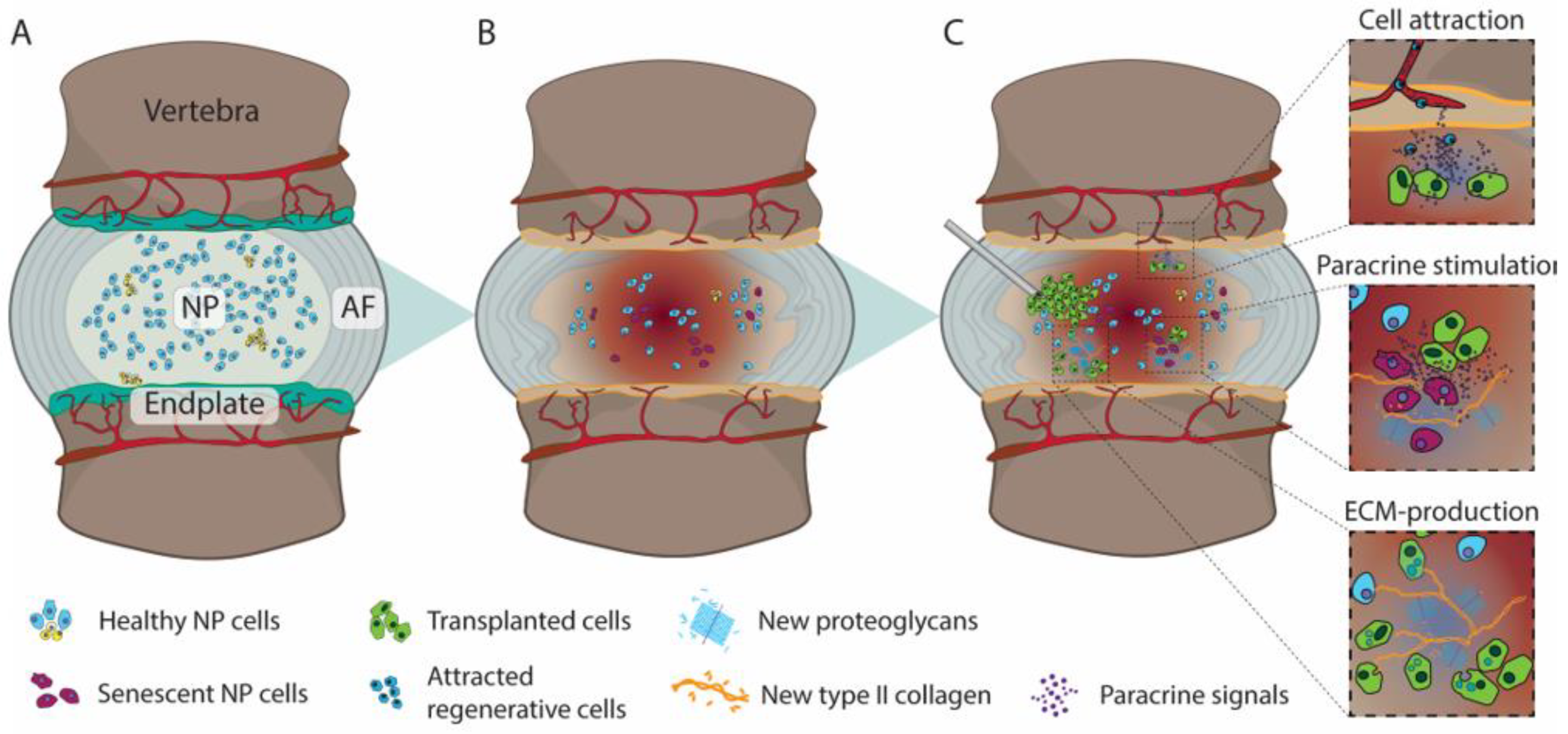 Clinical Development of Regenerative Medicine Targeted for