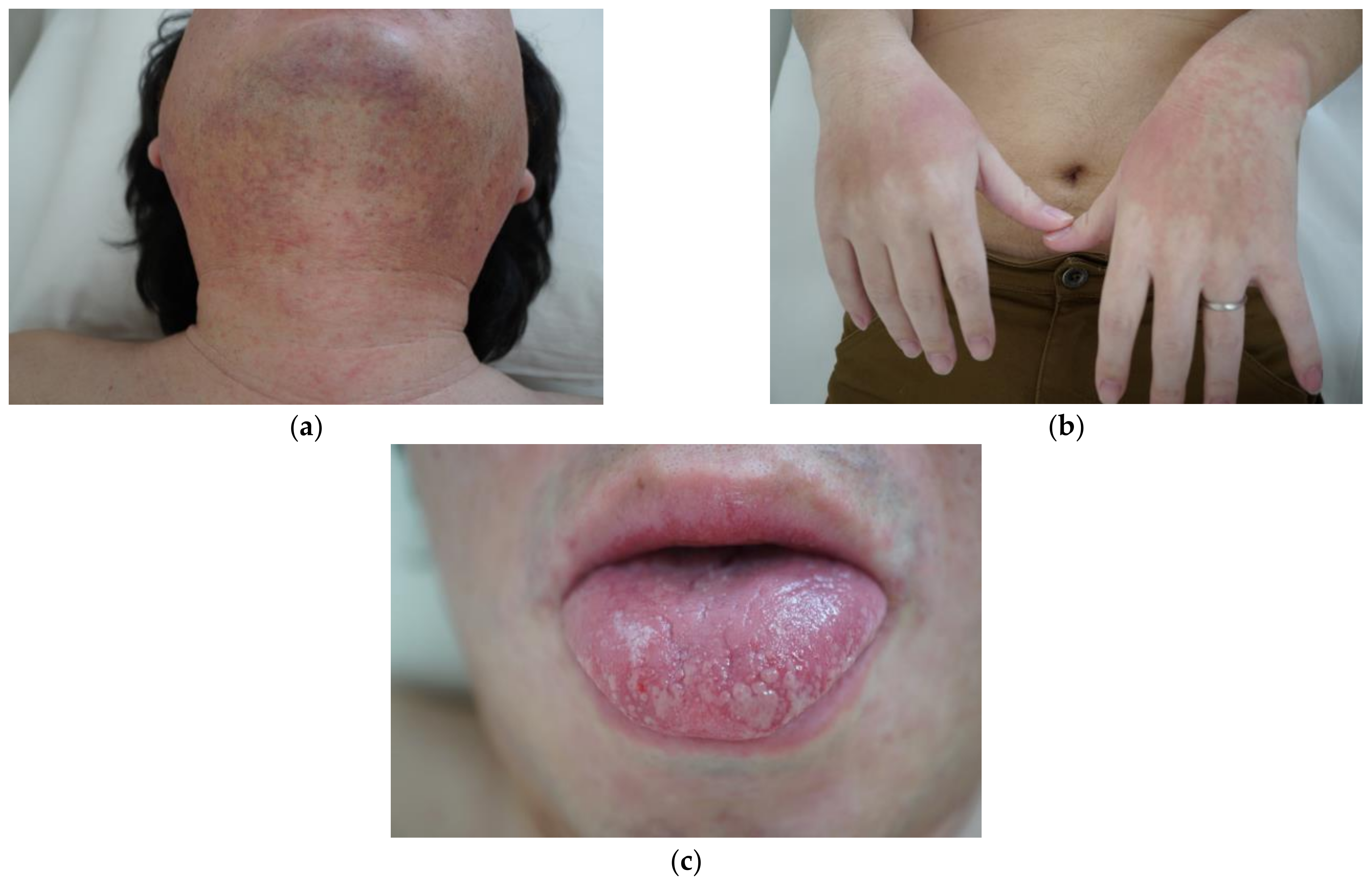 Medicina 58 00276 g002 550