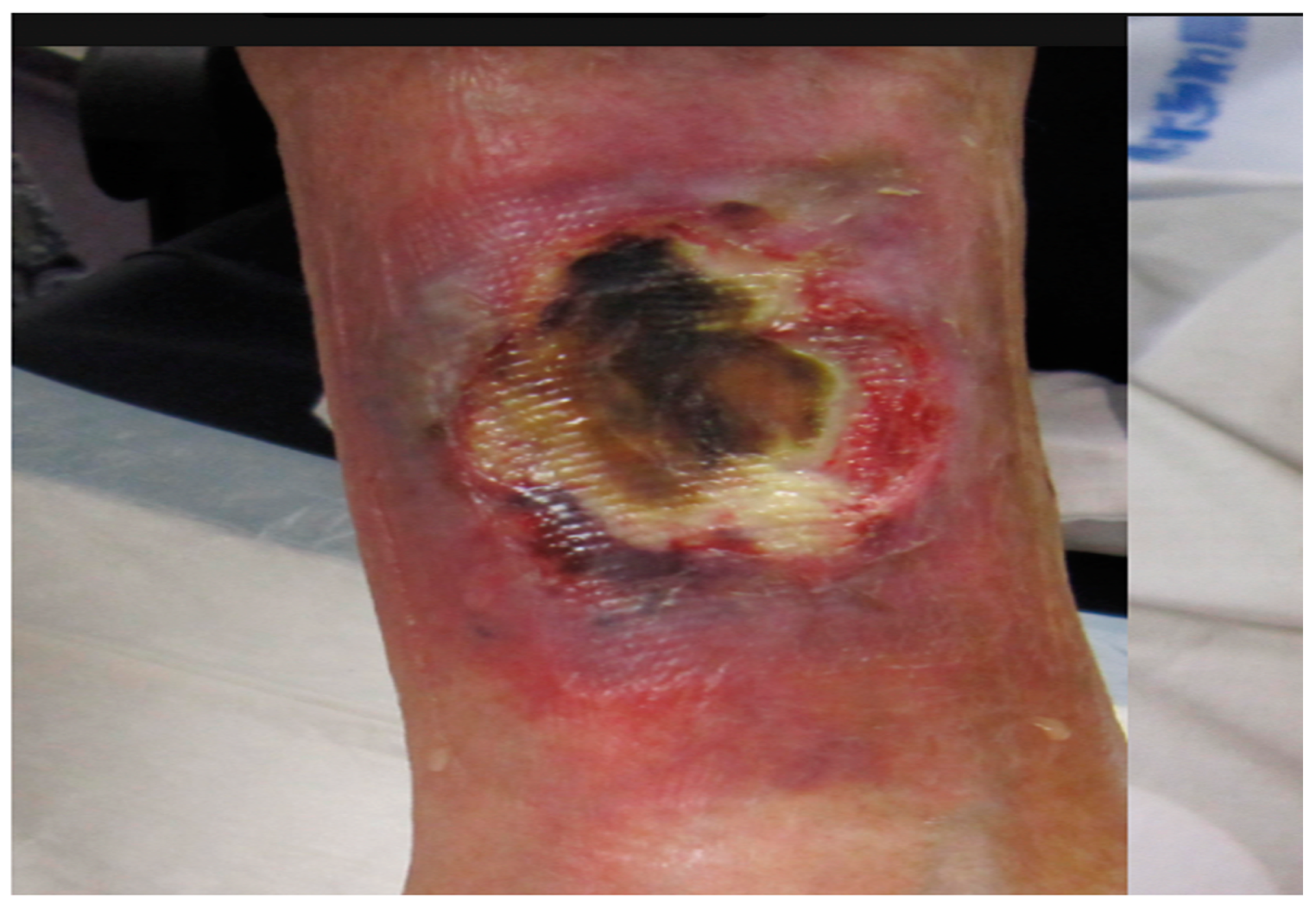 Medicina 58 00292 g001 550