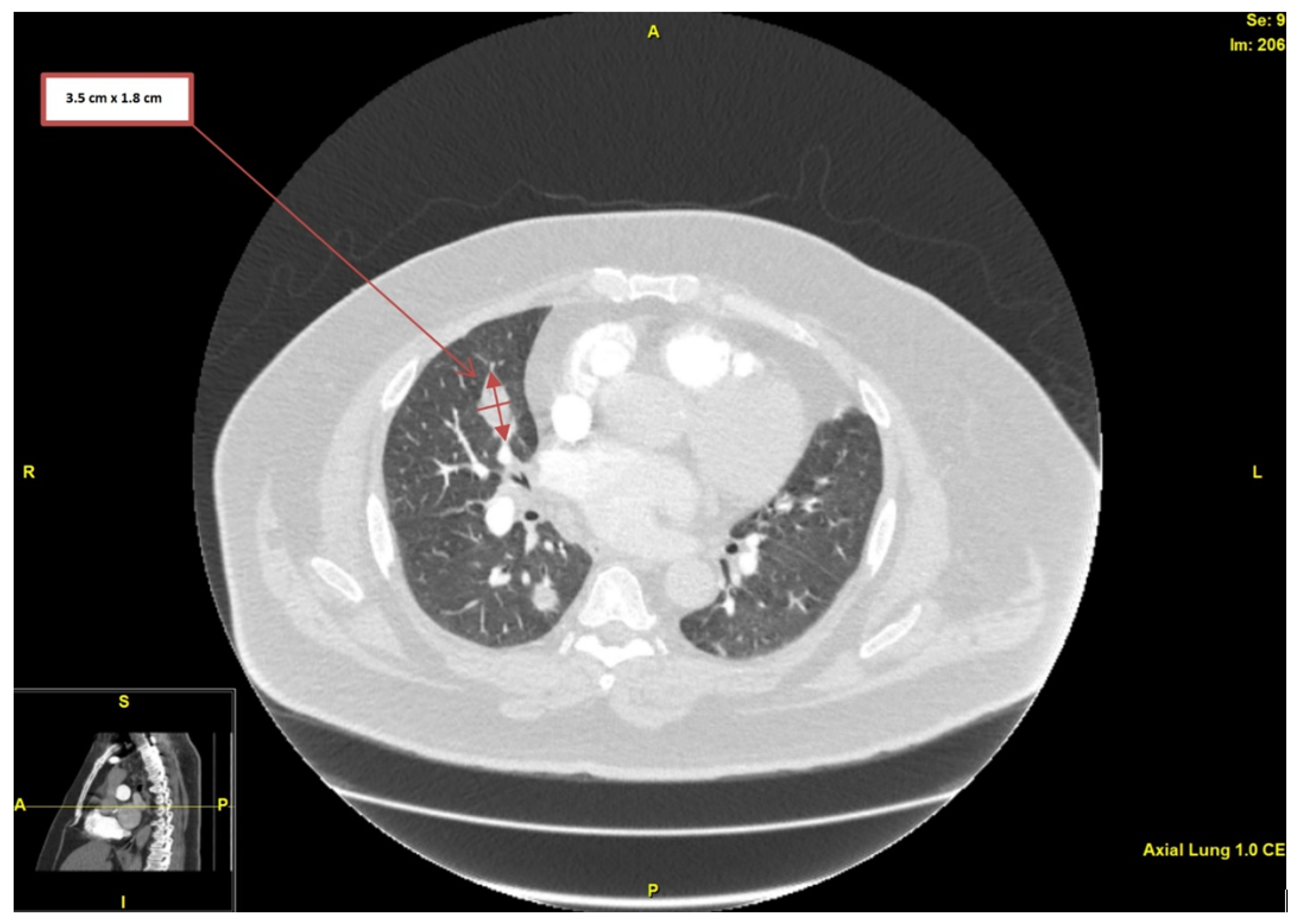 Medicina 58 00307 g001 550