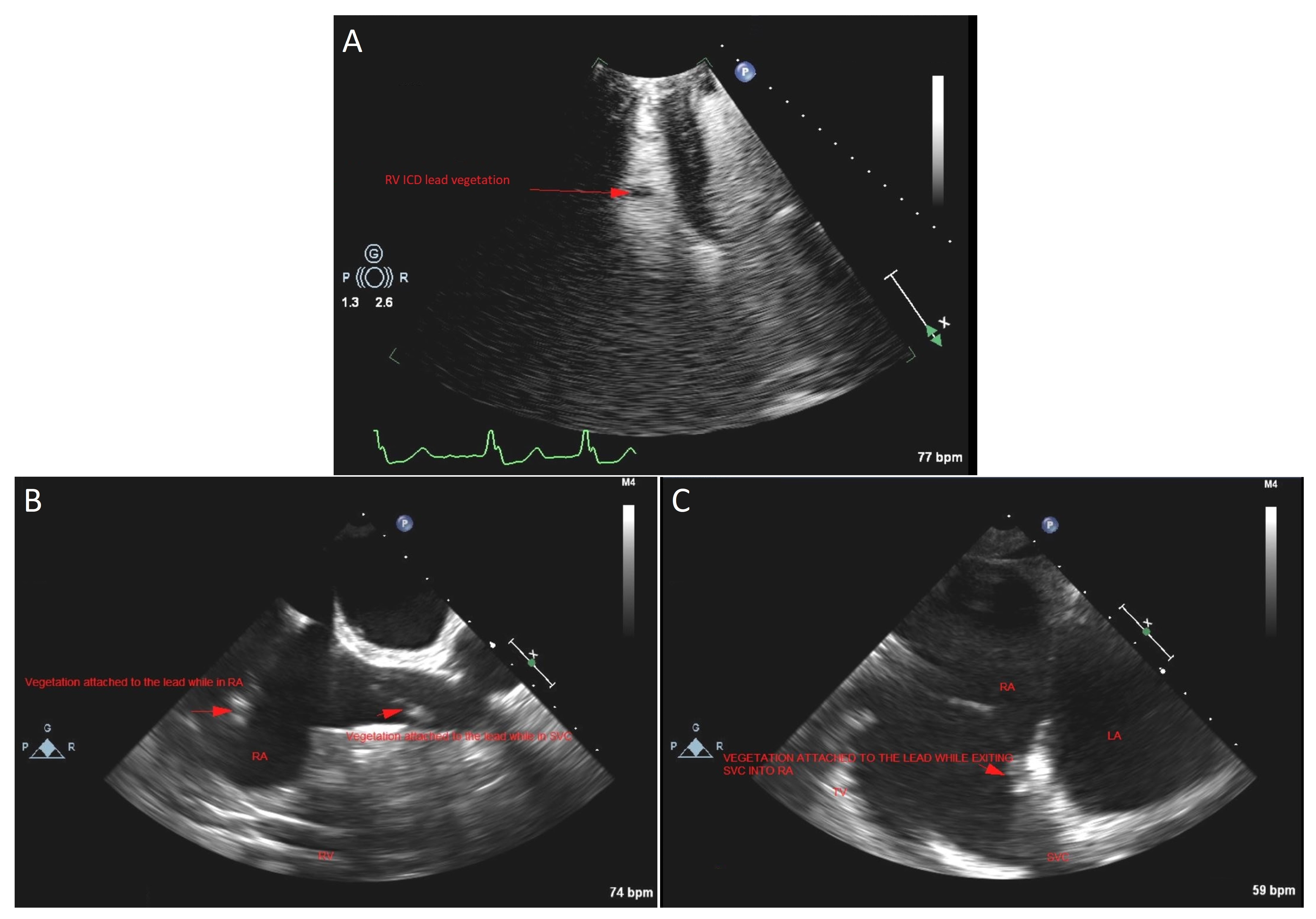 Medicina 58 00307 g002 550