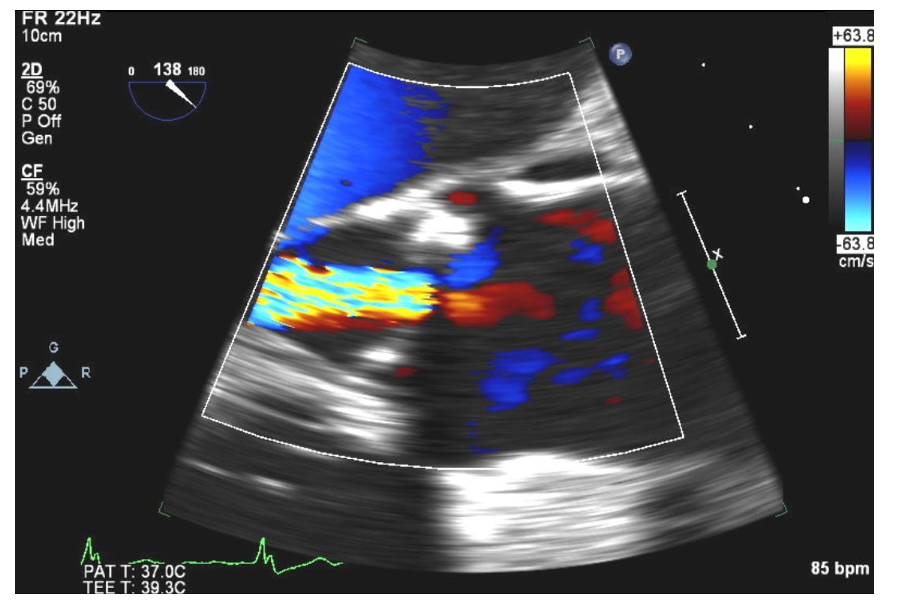 Medicina 58 00307 g003 550