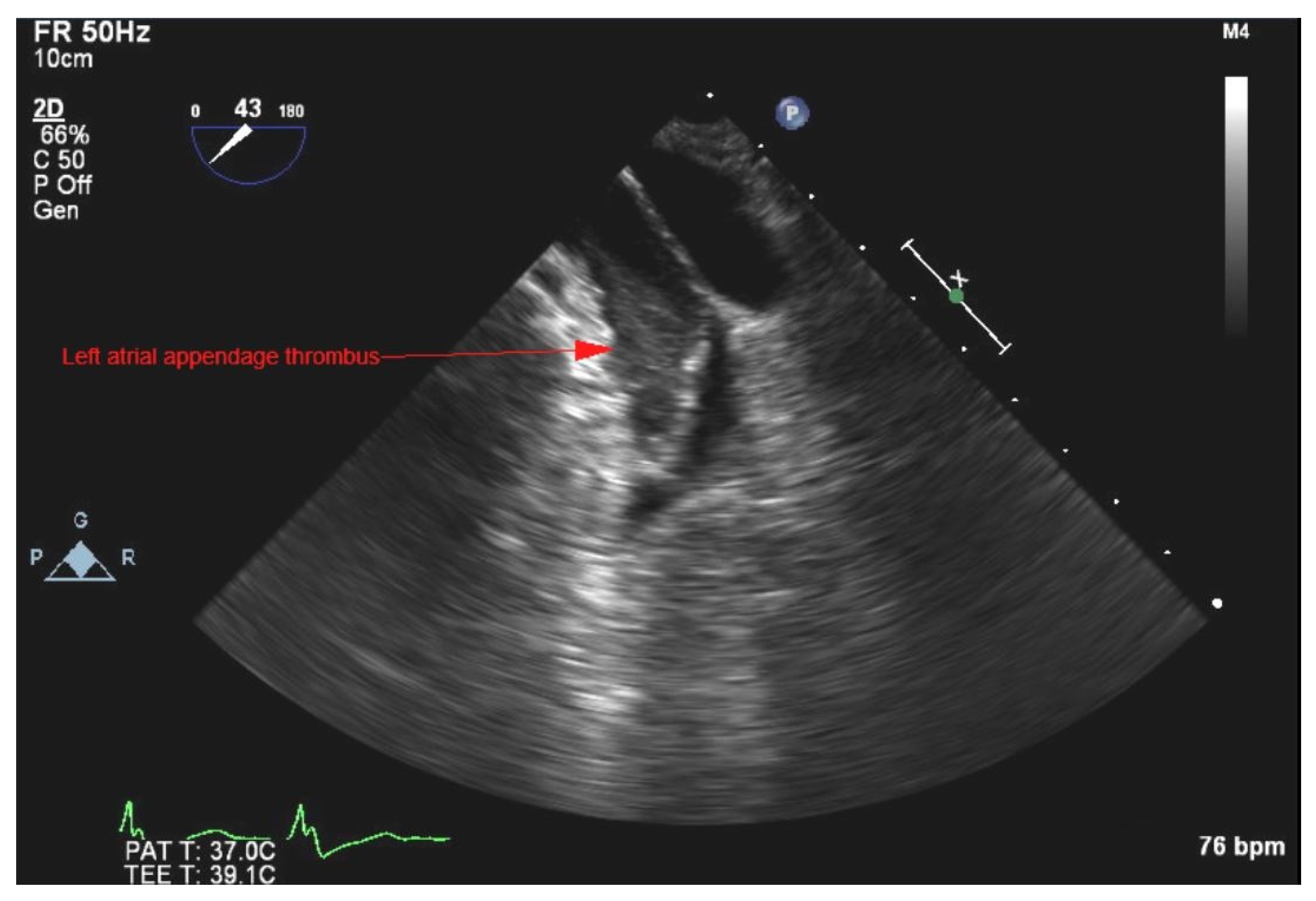 Medicina 58 00307 g004 550