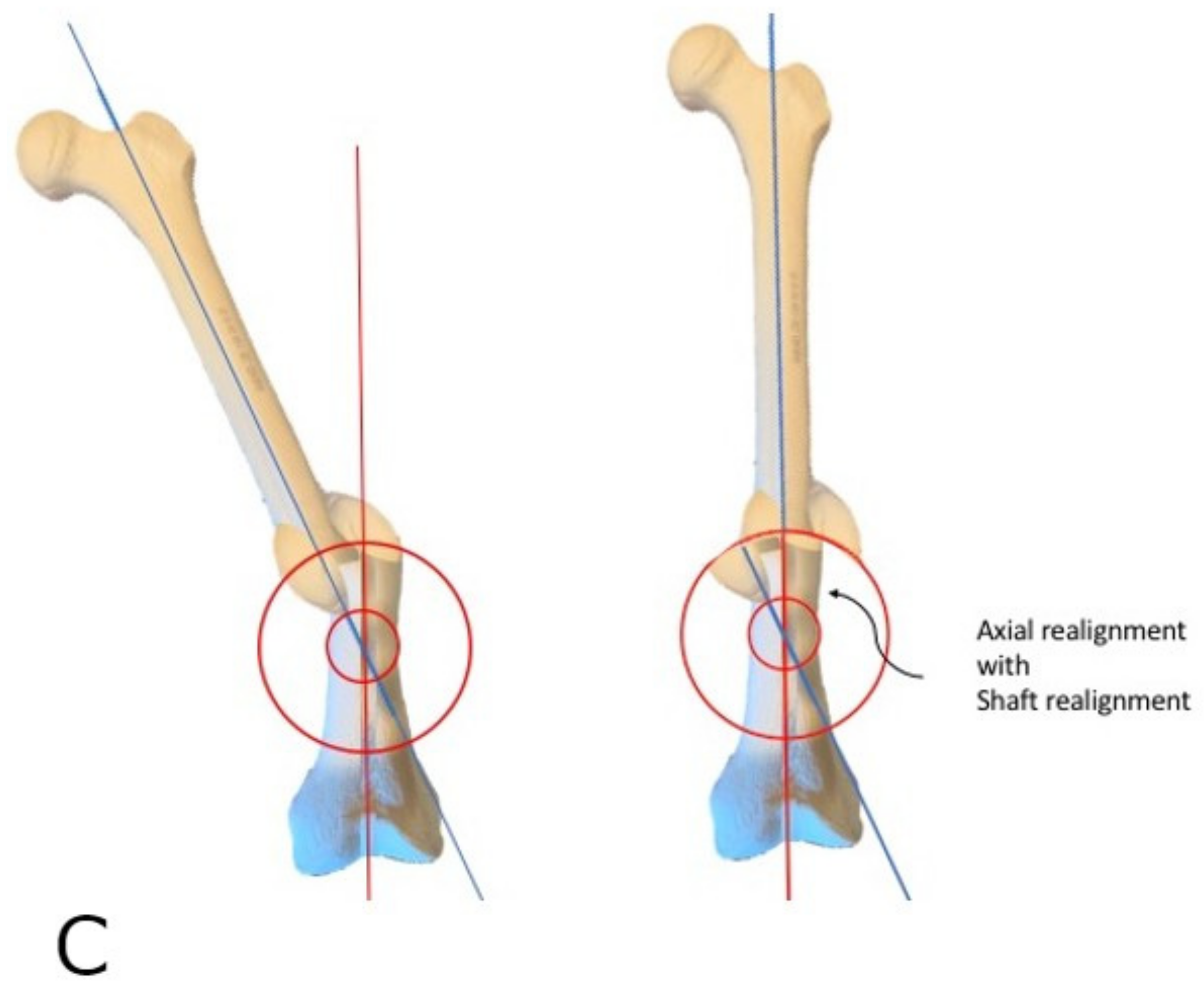 Medicina 58 00308 g005b