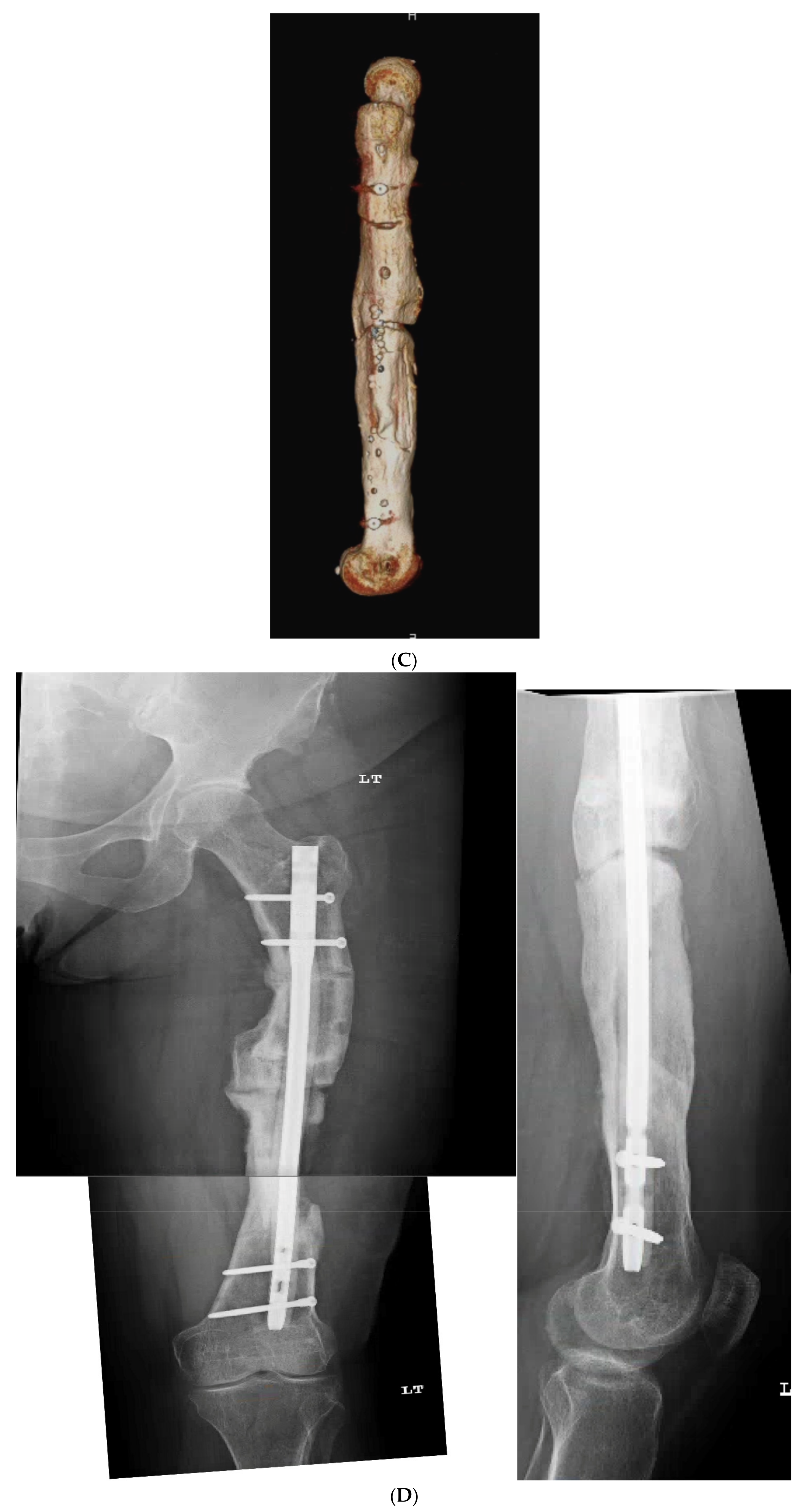 Medicina 58 00308 g006c