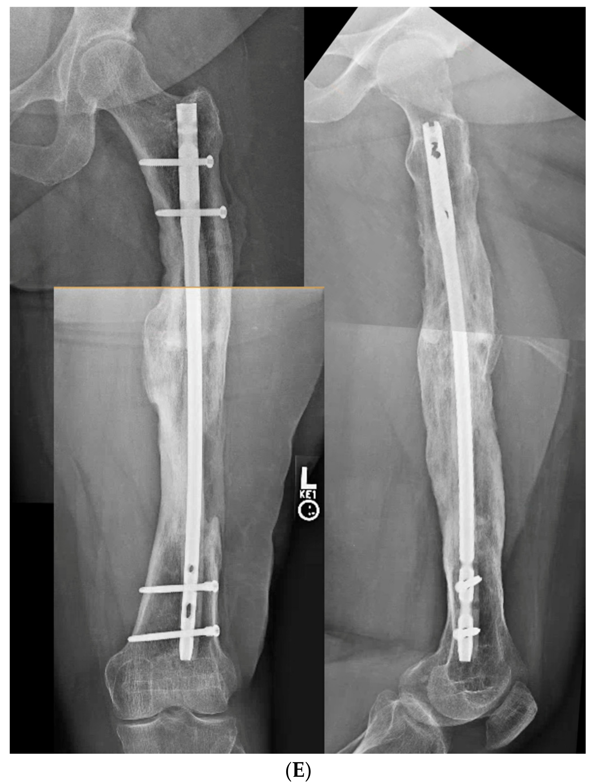 Medicina 58 00308 g006d