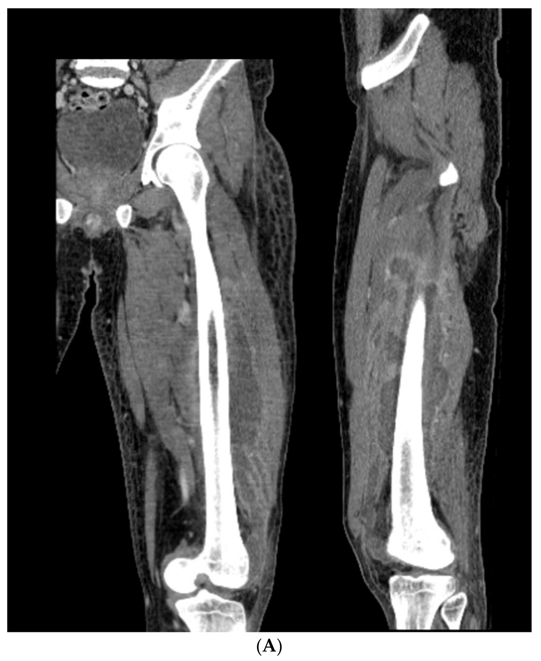 Medicina 58 00308 g009a