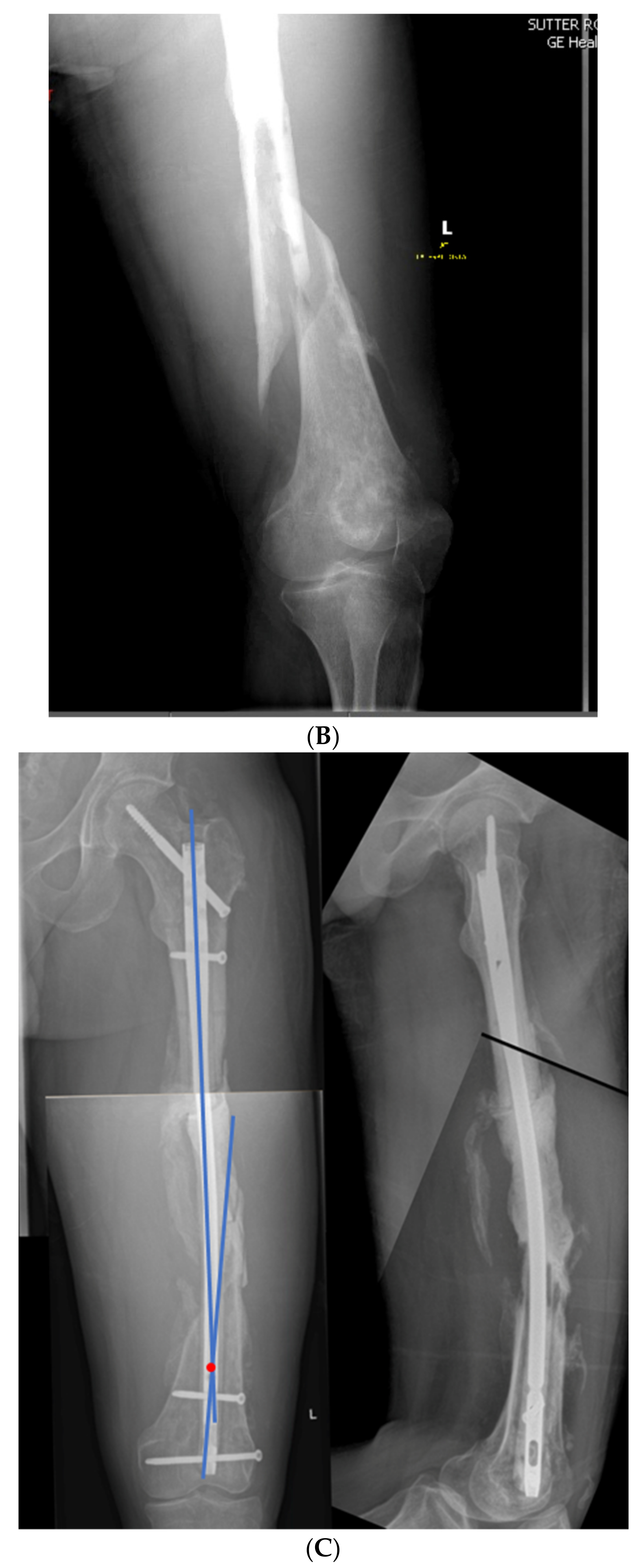 Medicina 58 00308 g009b