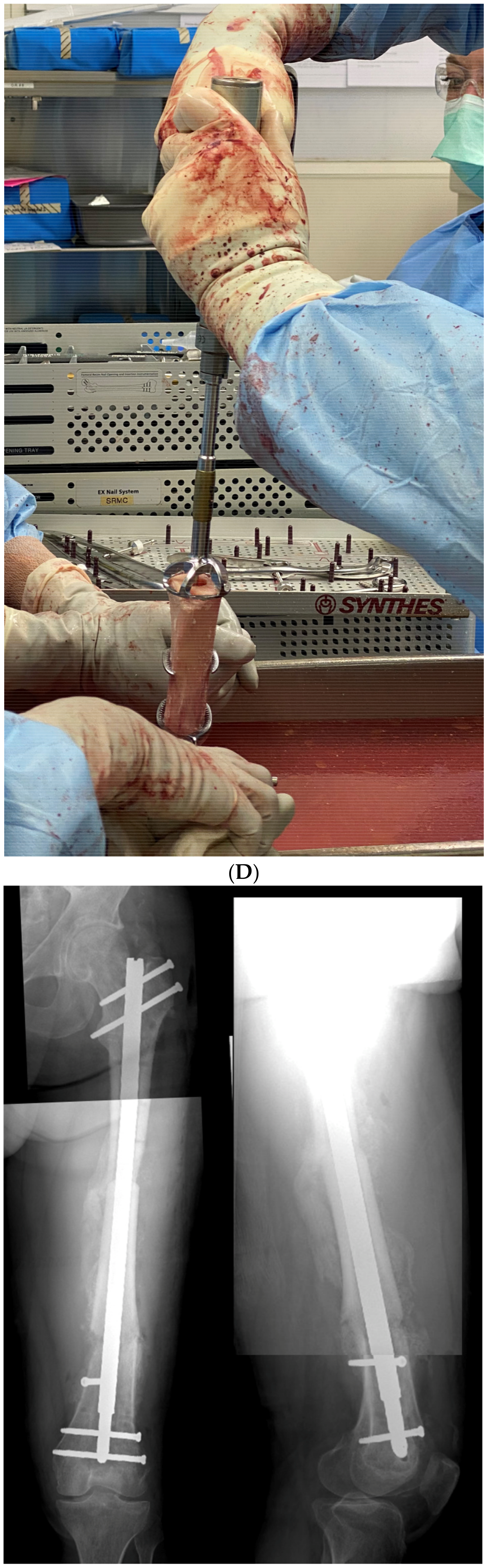 Medicina 58 00308 g009c