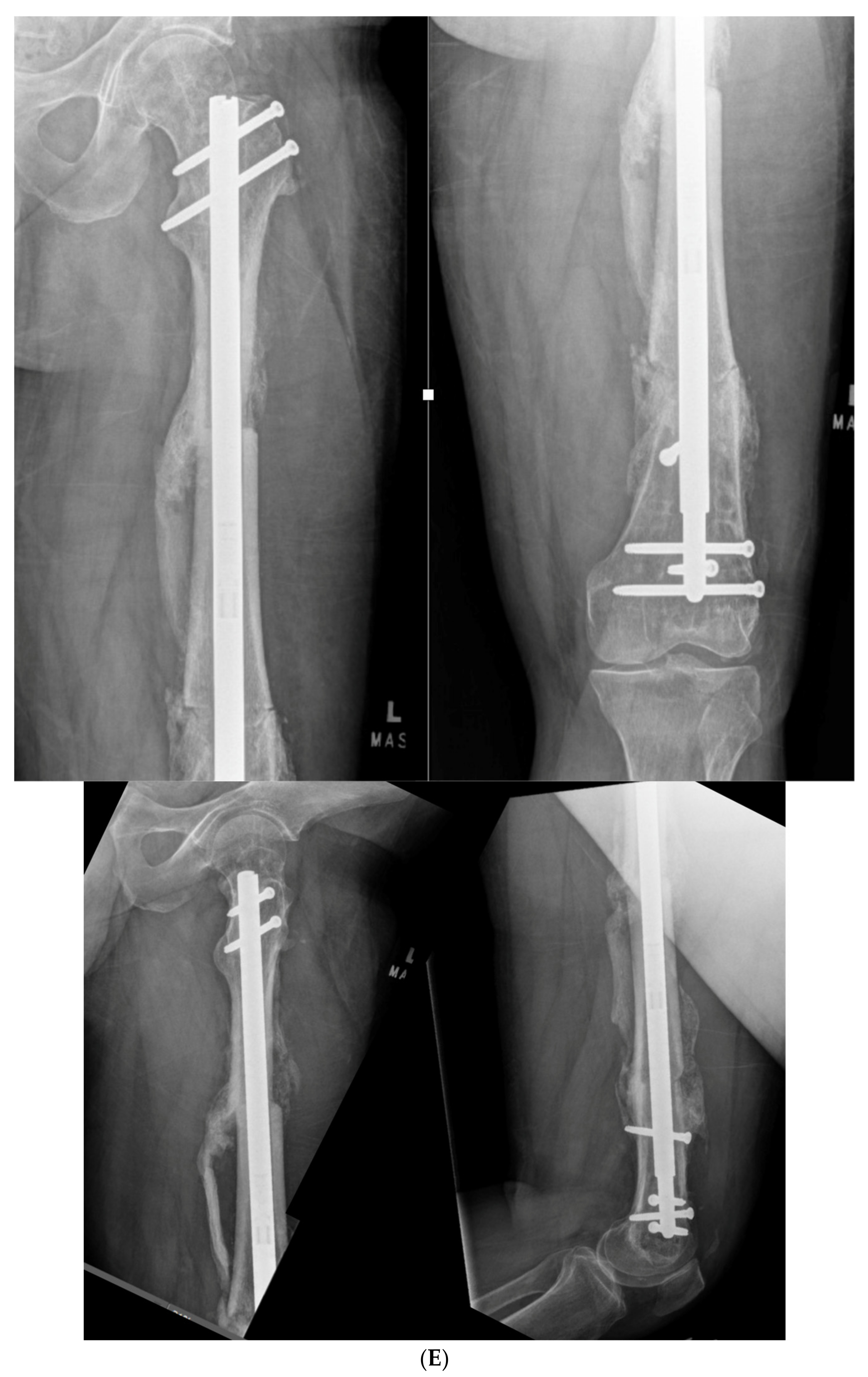 Medicina 58 00308 g009d