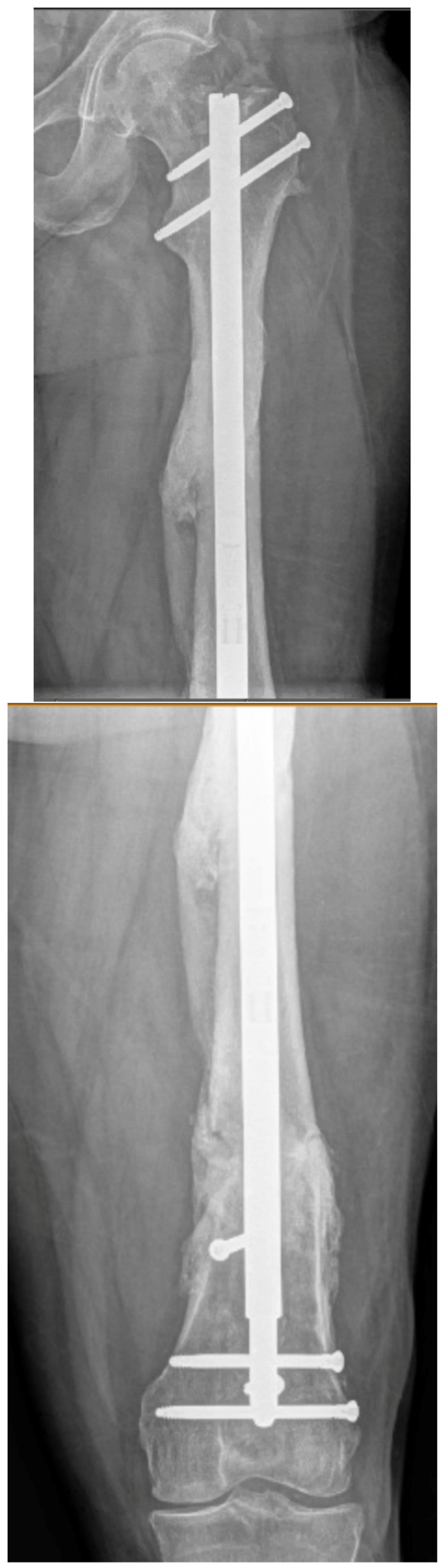 Medicina 58 00308 g009e