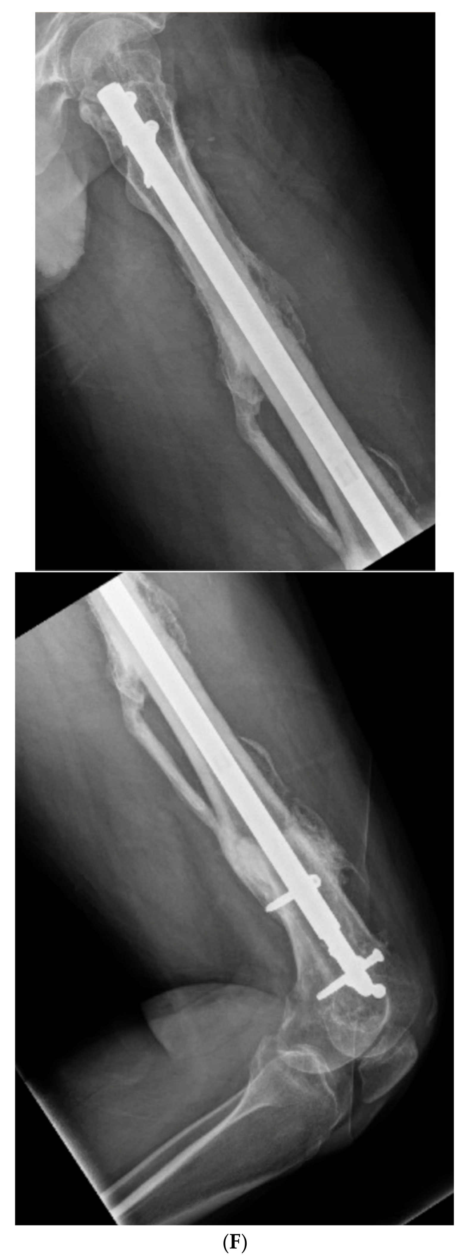 Medicina 58 00308 g009f