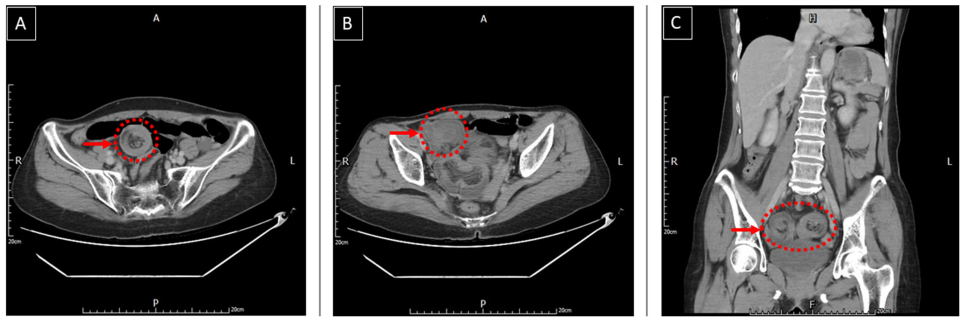 Medicina 58 00310 g002 550