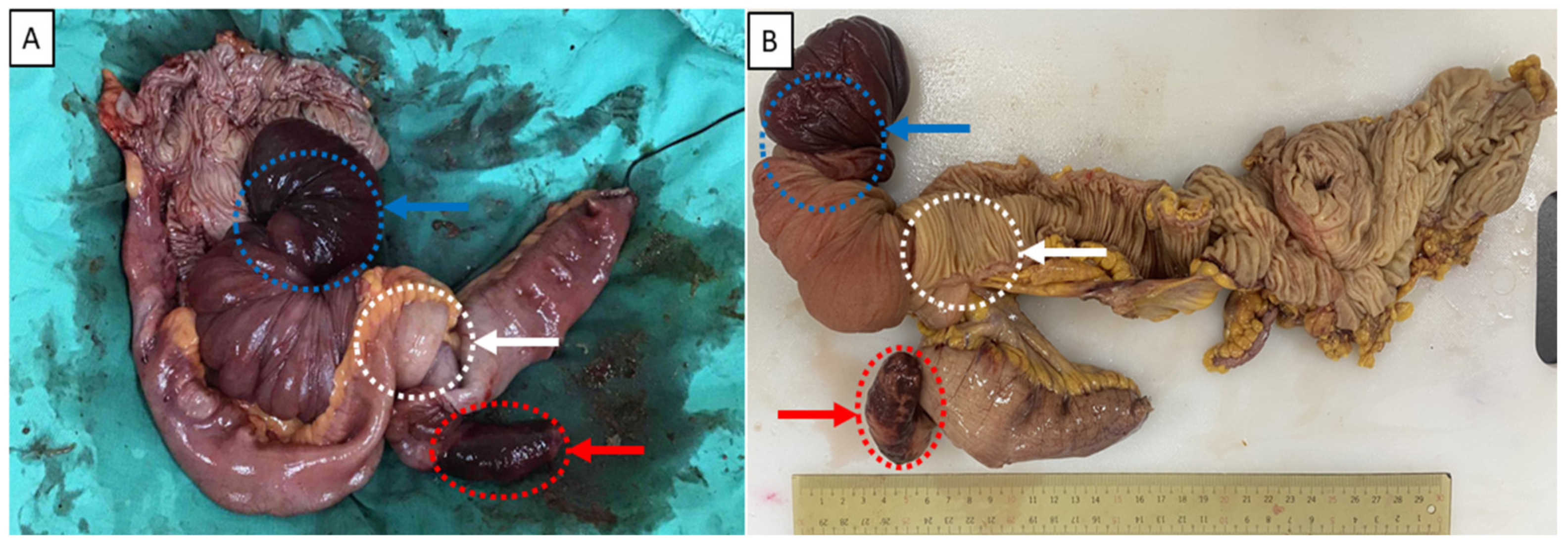 Medicina 58 00310 g003 550
