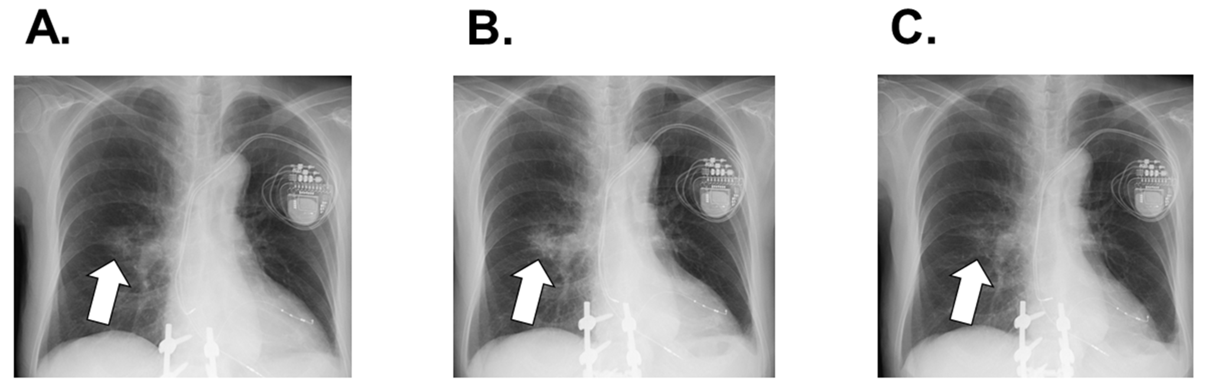 Medicina 58 00312 g006 550