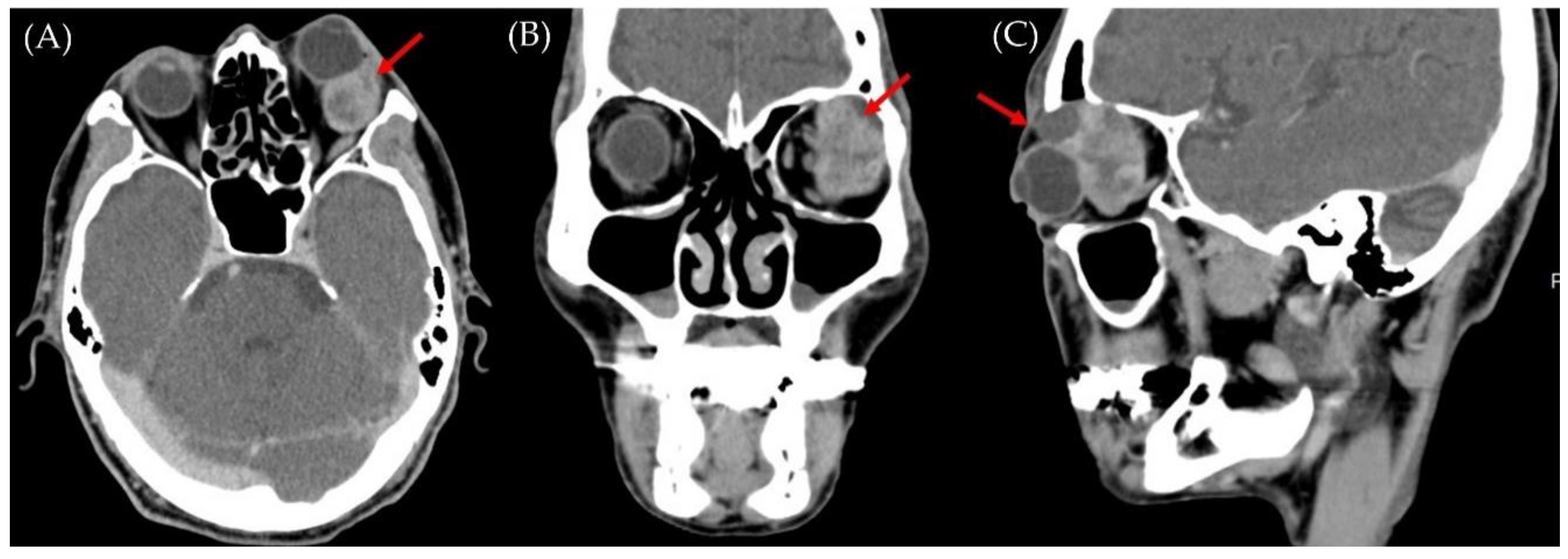 Medicina 58 00317 g002