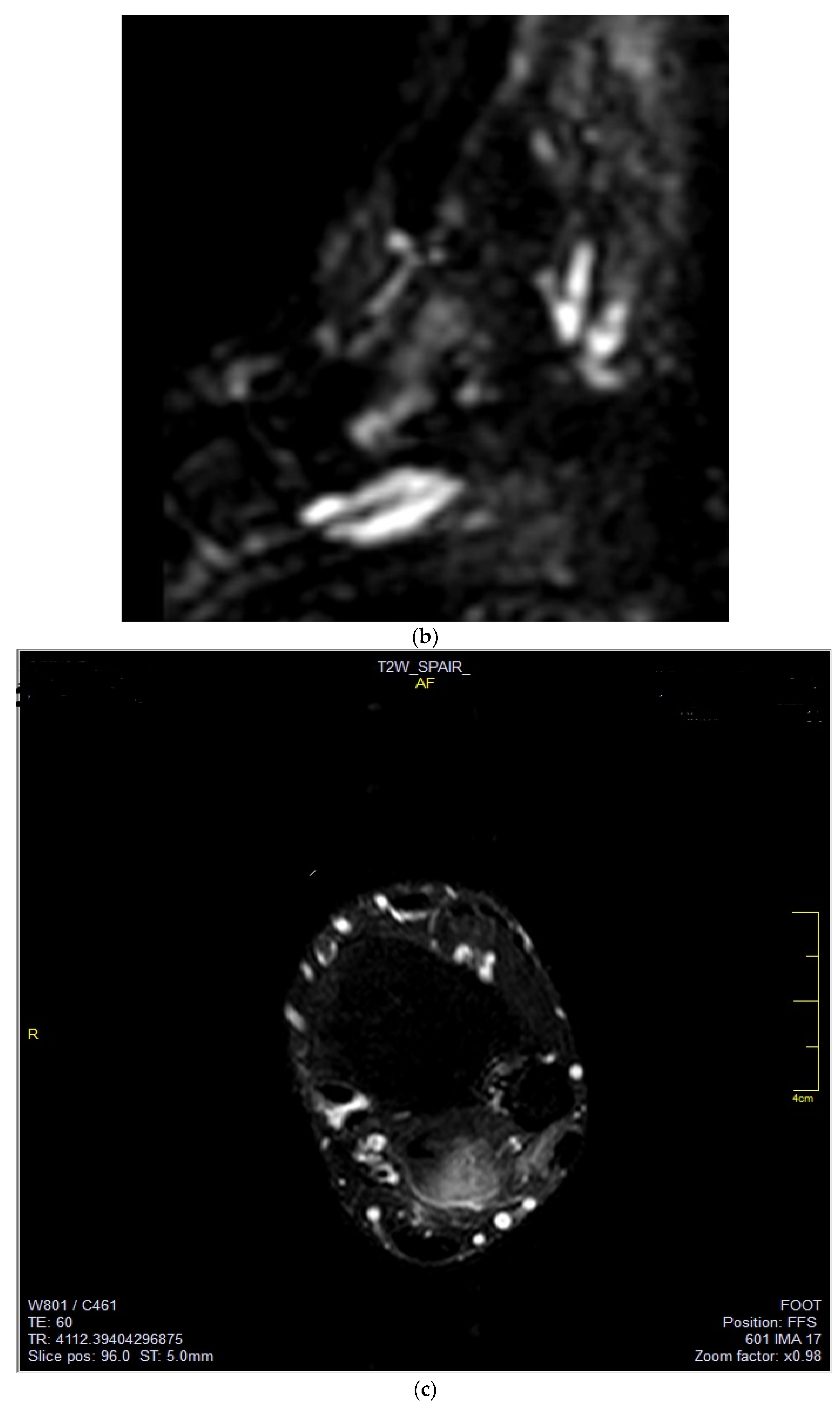 Medicina 58 00321 g003b