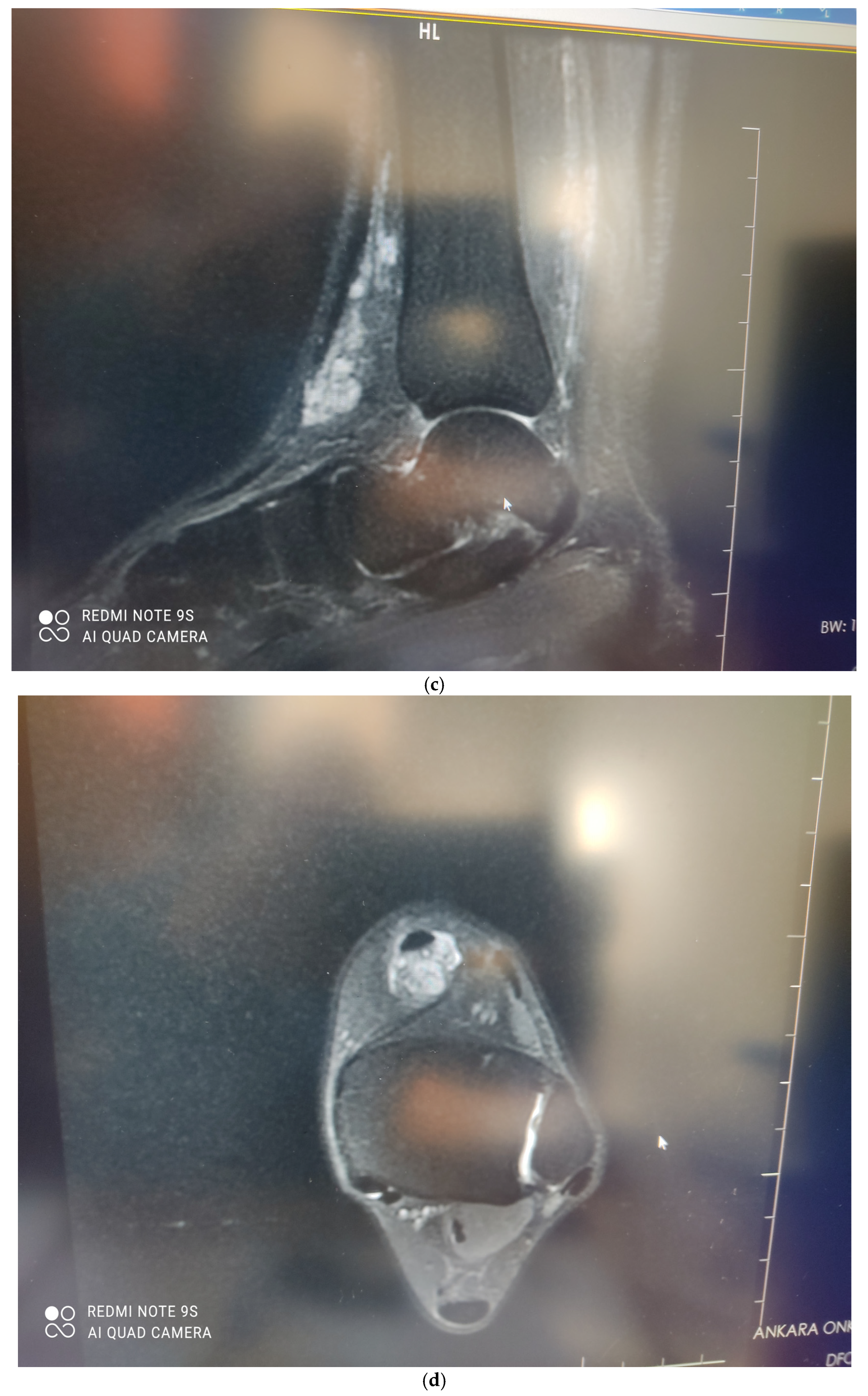 Medicina 58 00321 g005b