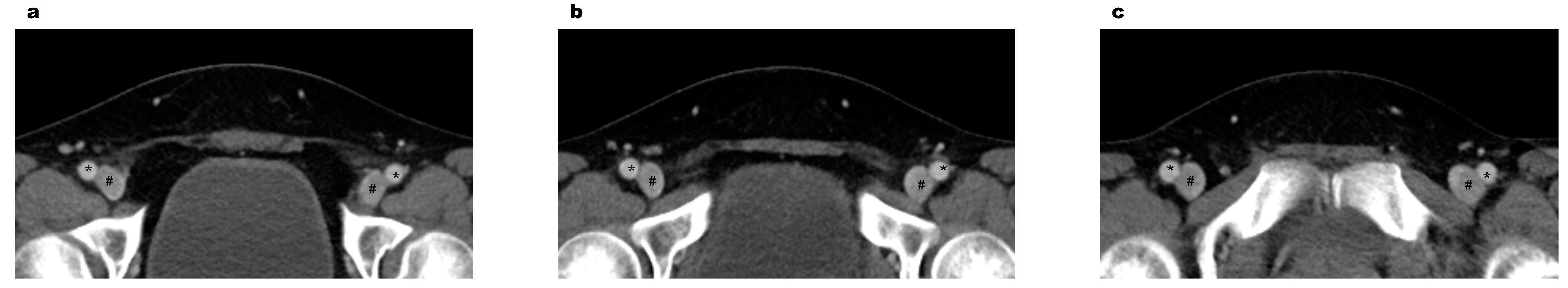 Medicina 58 00325 g002 550