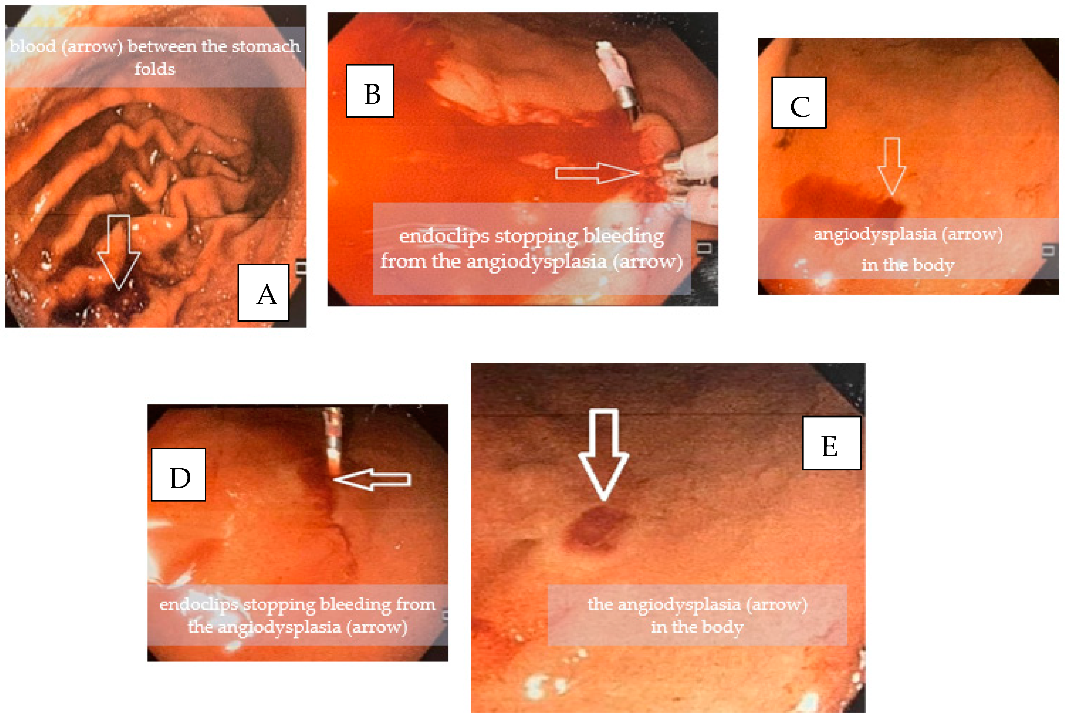 Medicina 58 00333 g001