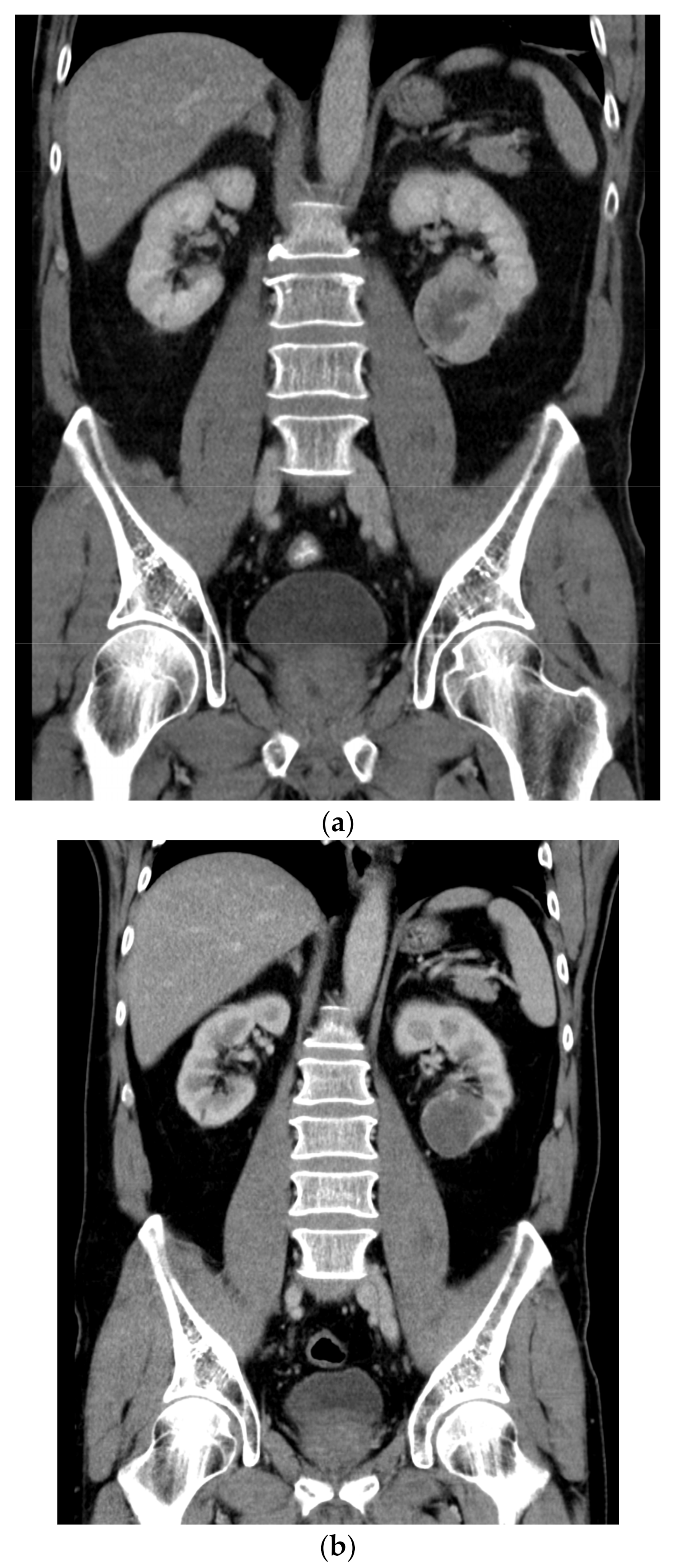 Medicina 58 00336 g001 550