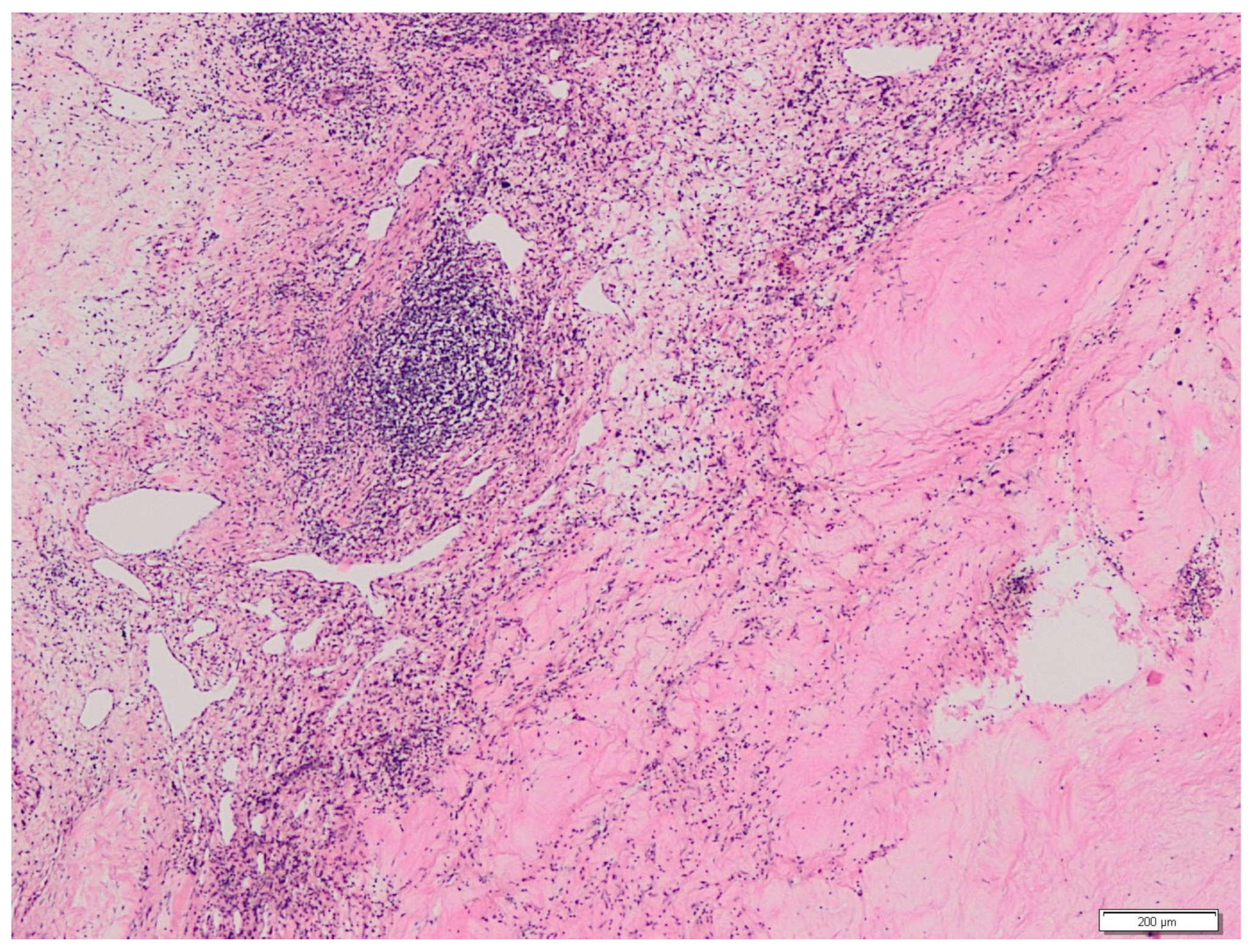 Medicina 58 00336 g003 550