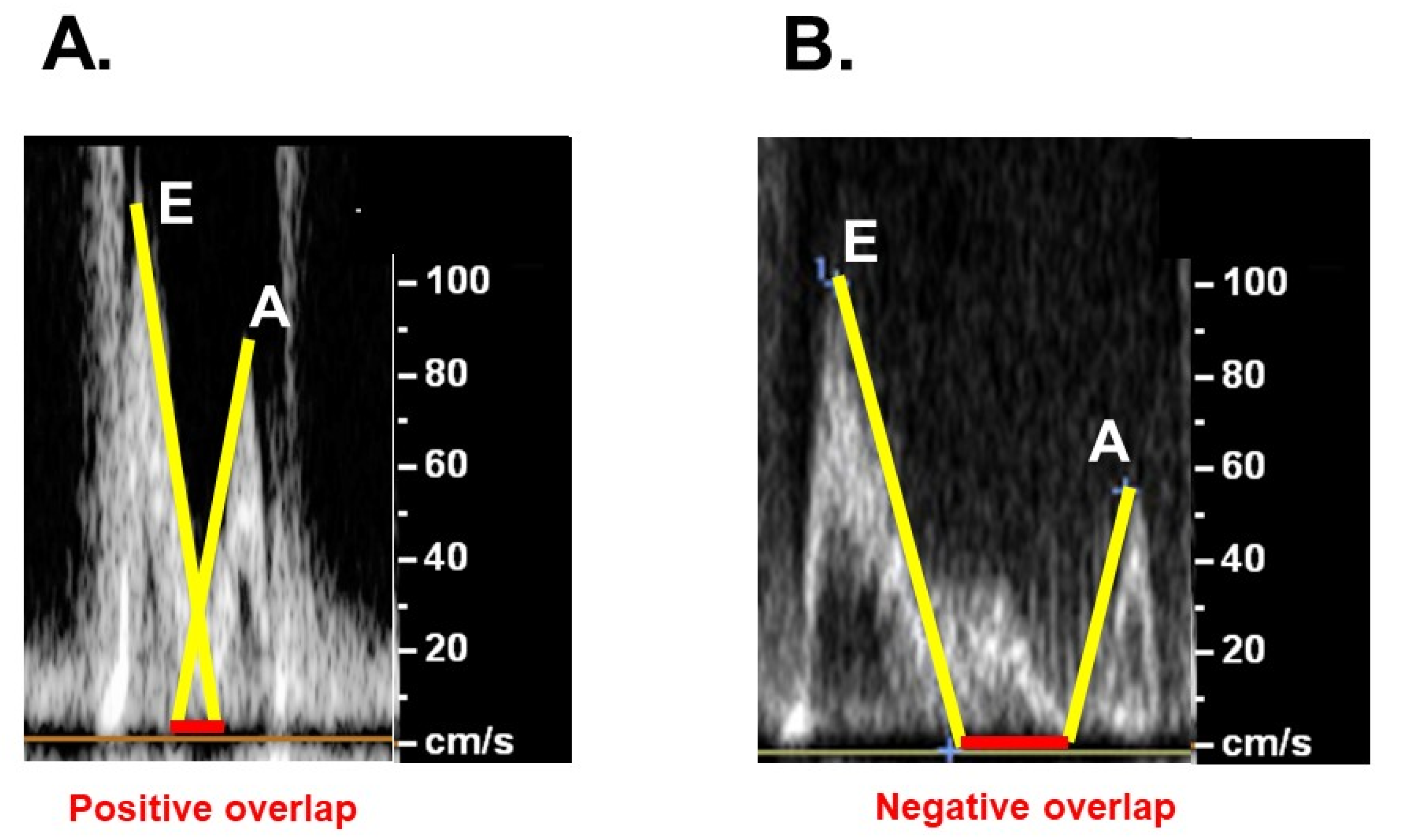 Medicina 58 00347 g005 Medicina 58 00347 g005