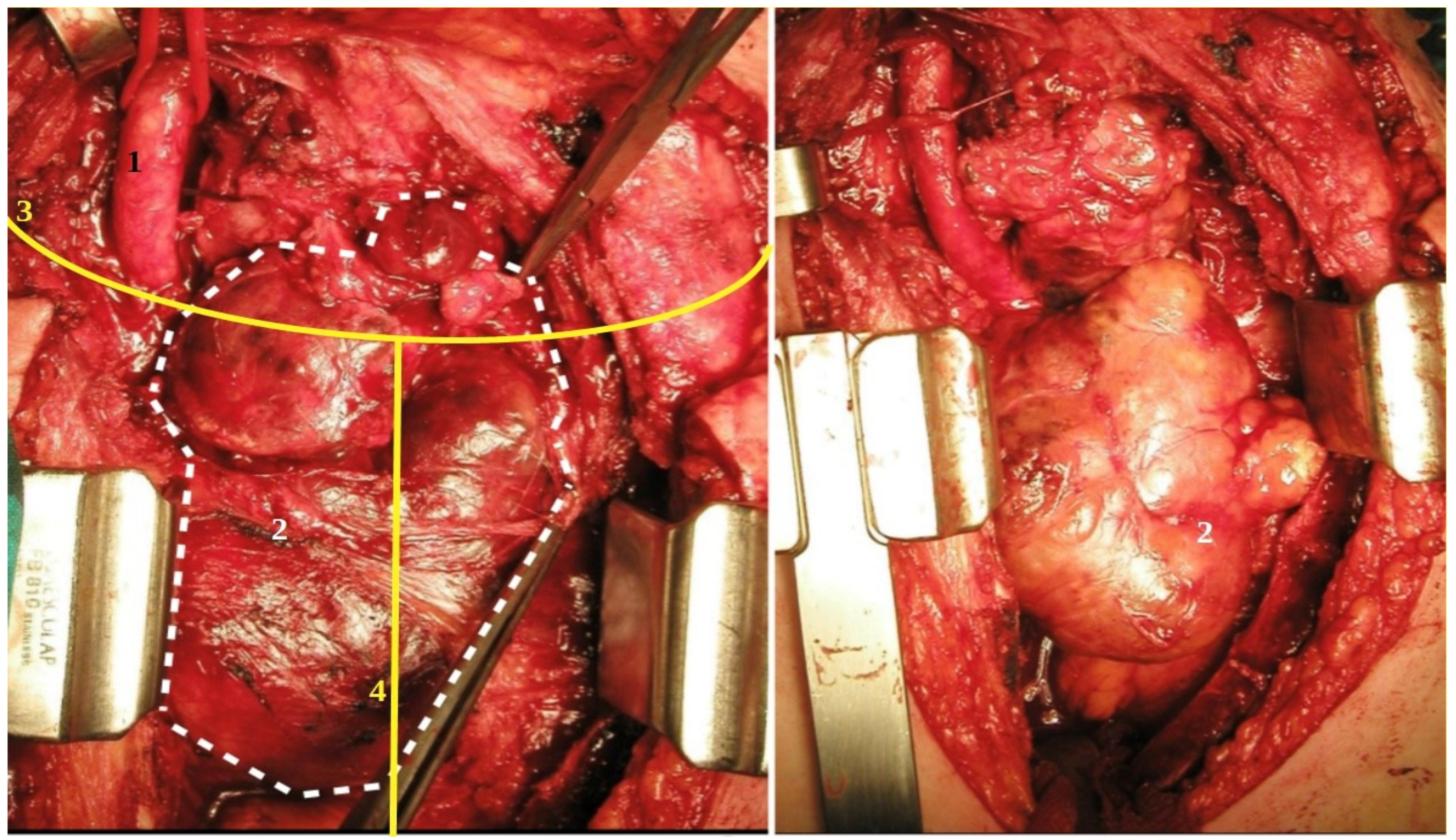Medicina 58 00349 g003 550